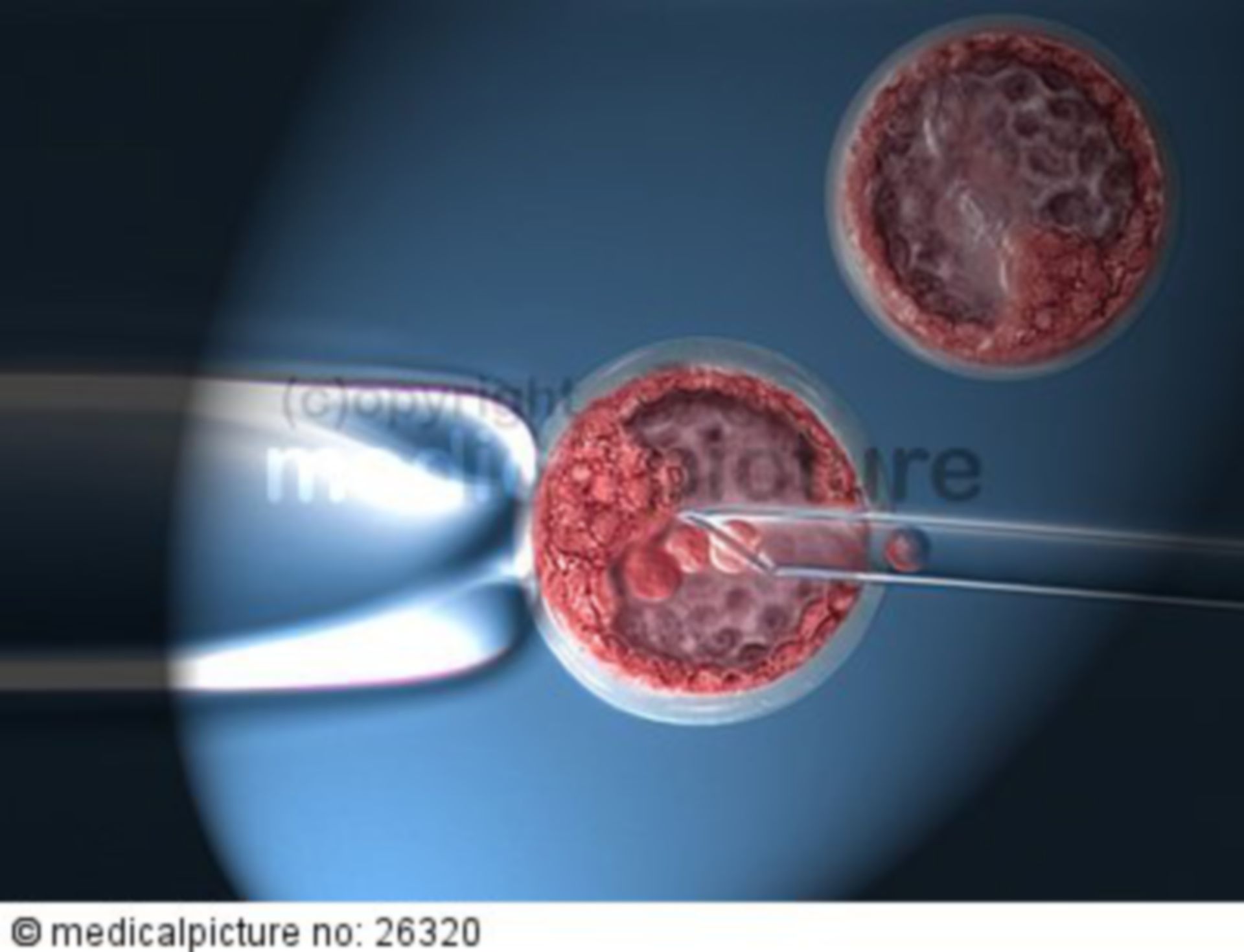  Entnahme von Stammzellen aus einer Blastozyste 
