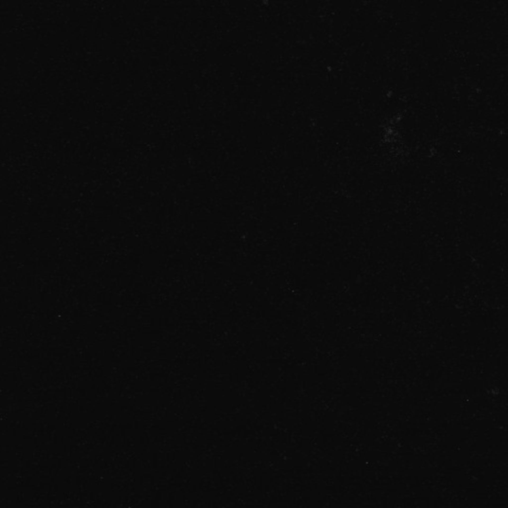 Xenopus laevis (Neuronal cell body) - CIL:36970