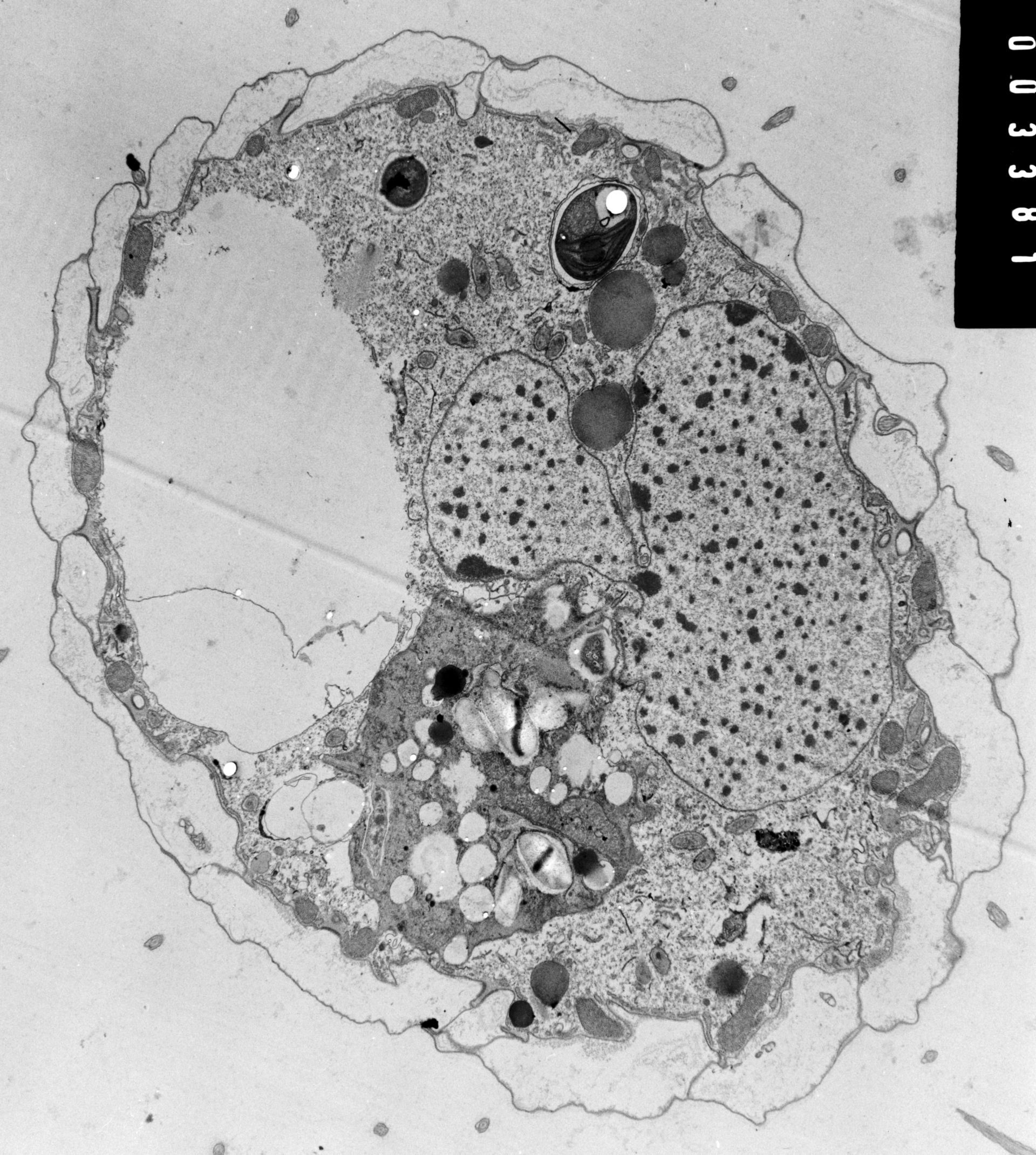 Coleps hirtus (Kinetal rows of cilia) - CIL:38828