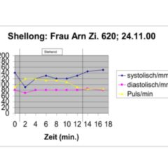 Schellong-Test - DocCheck Flexikon