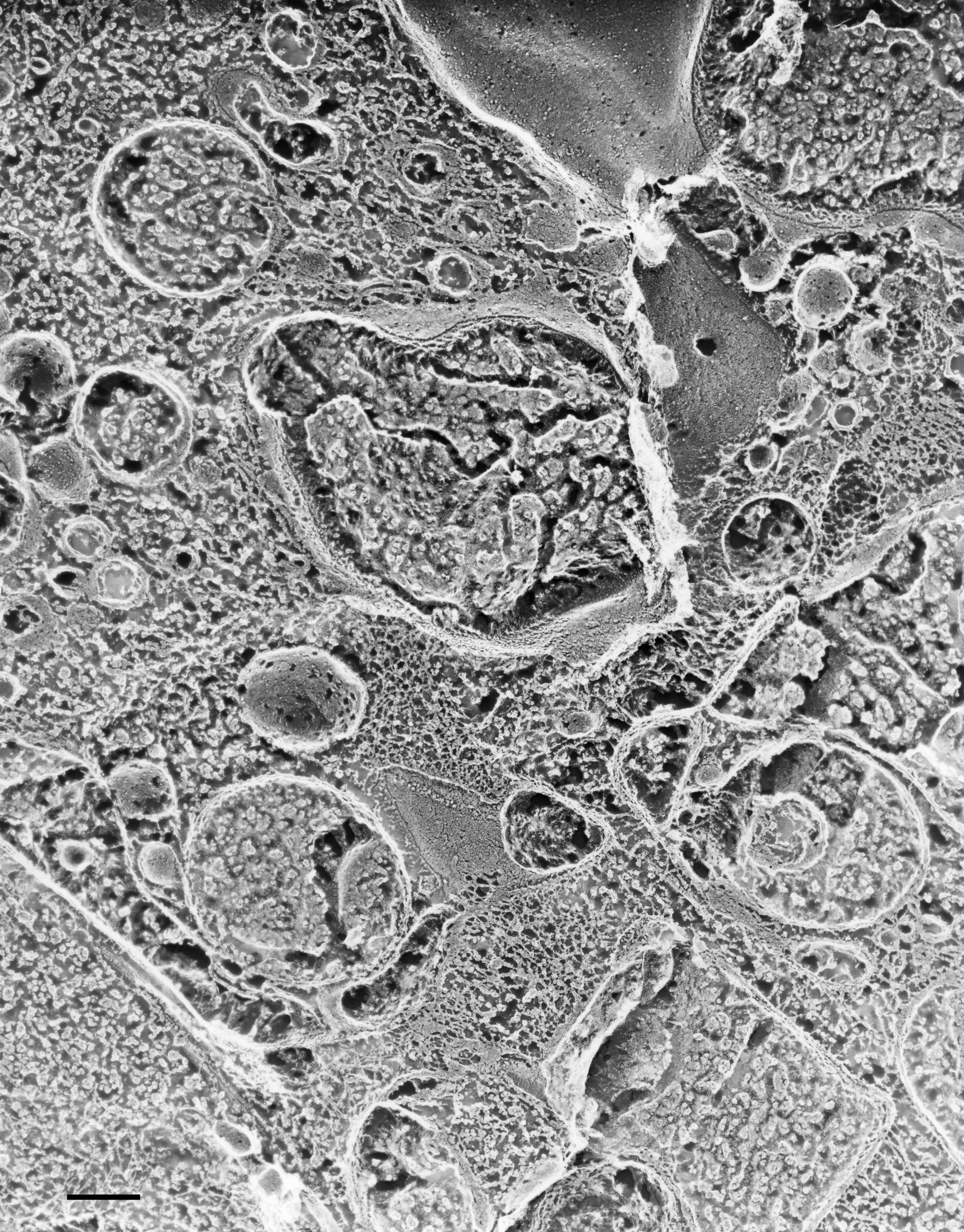 Paramecium multimicronucleatum (Cell cortex) - CIL:36617