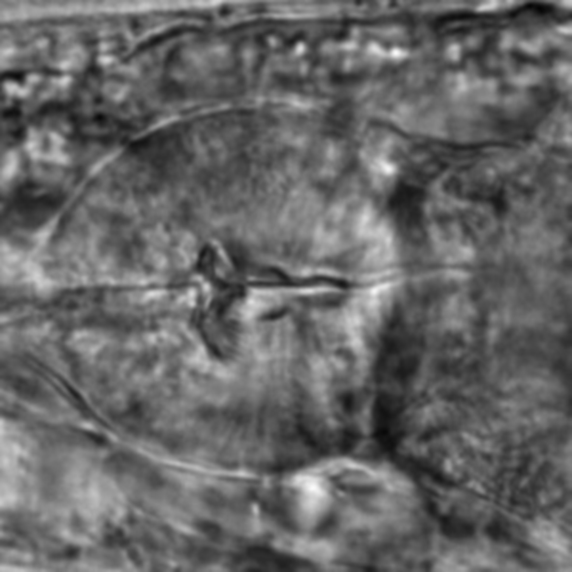 Caenorhabditis elegans - CIL:2127