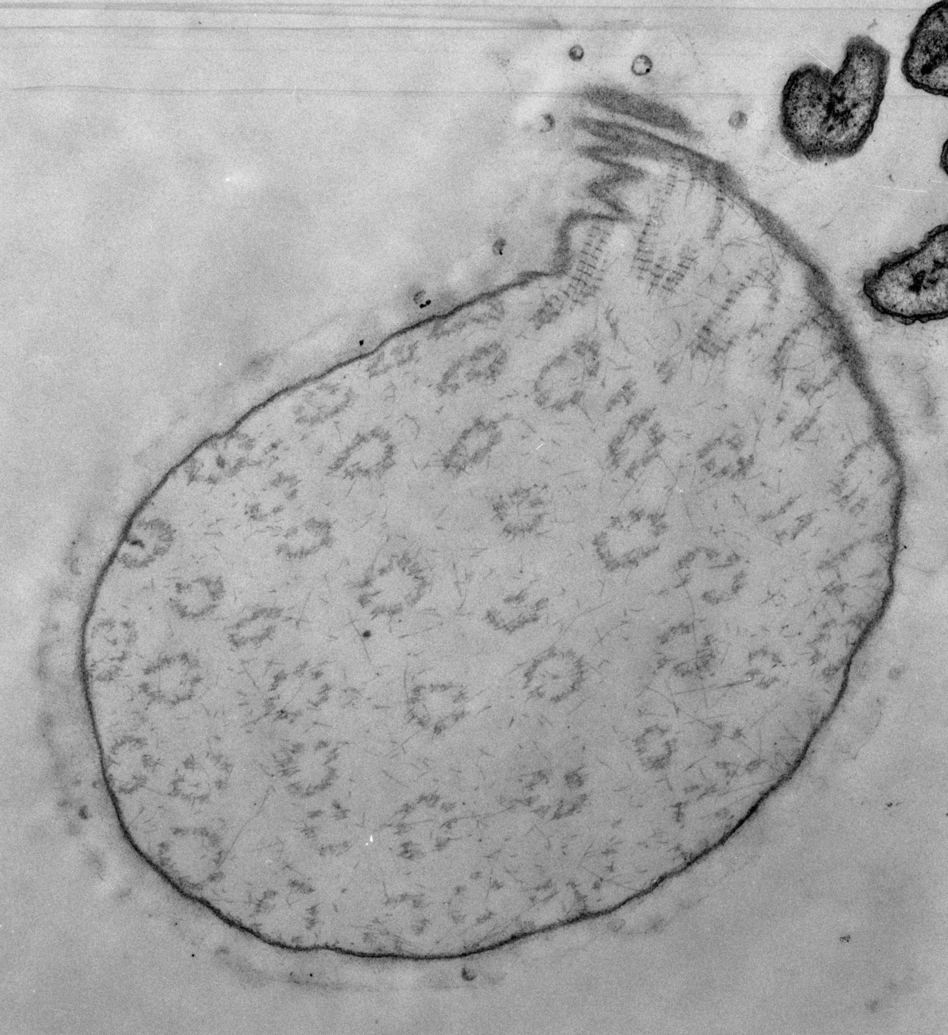 Opercularia coarctata (Extracellular matrix) - CIL:7455