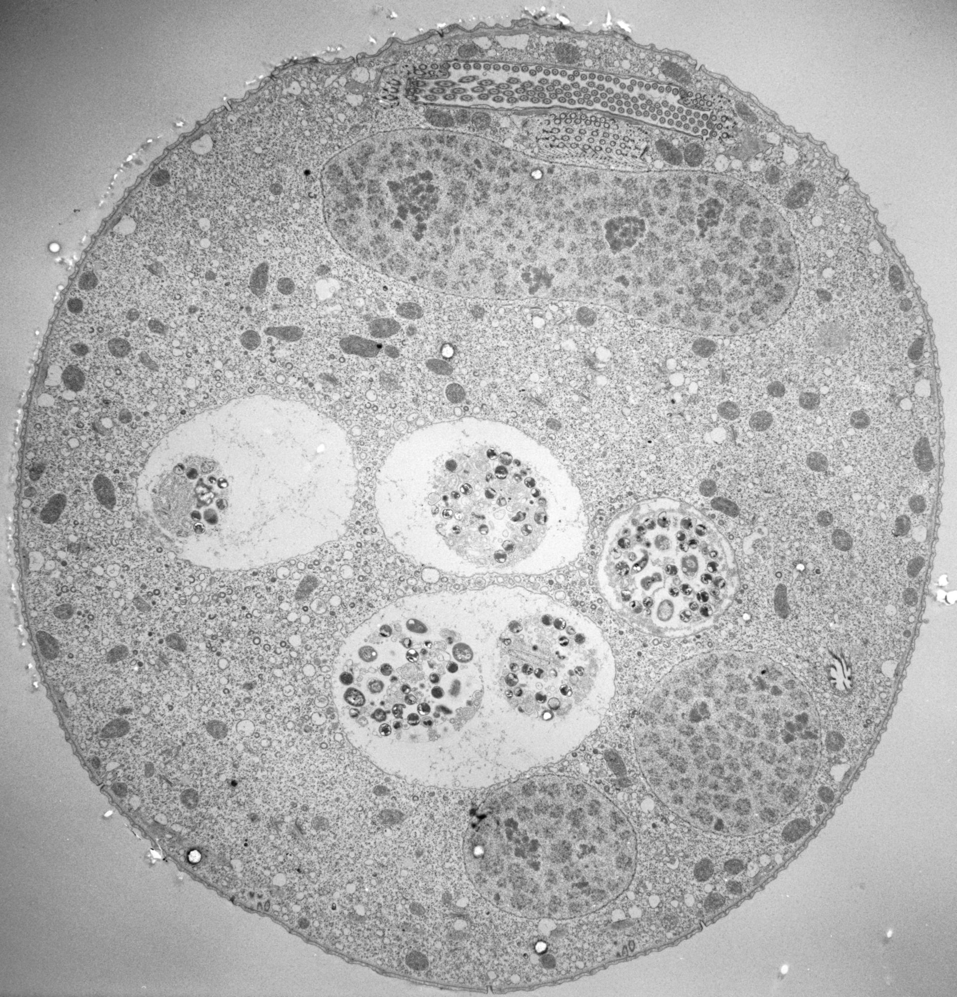 Vorticella convallaria (Cytopharynx) - CIL:39405