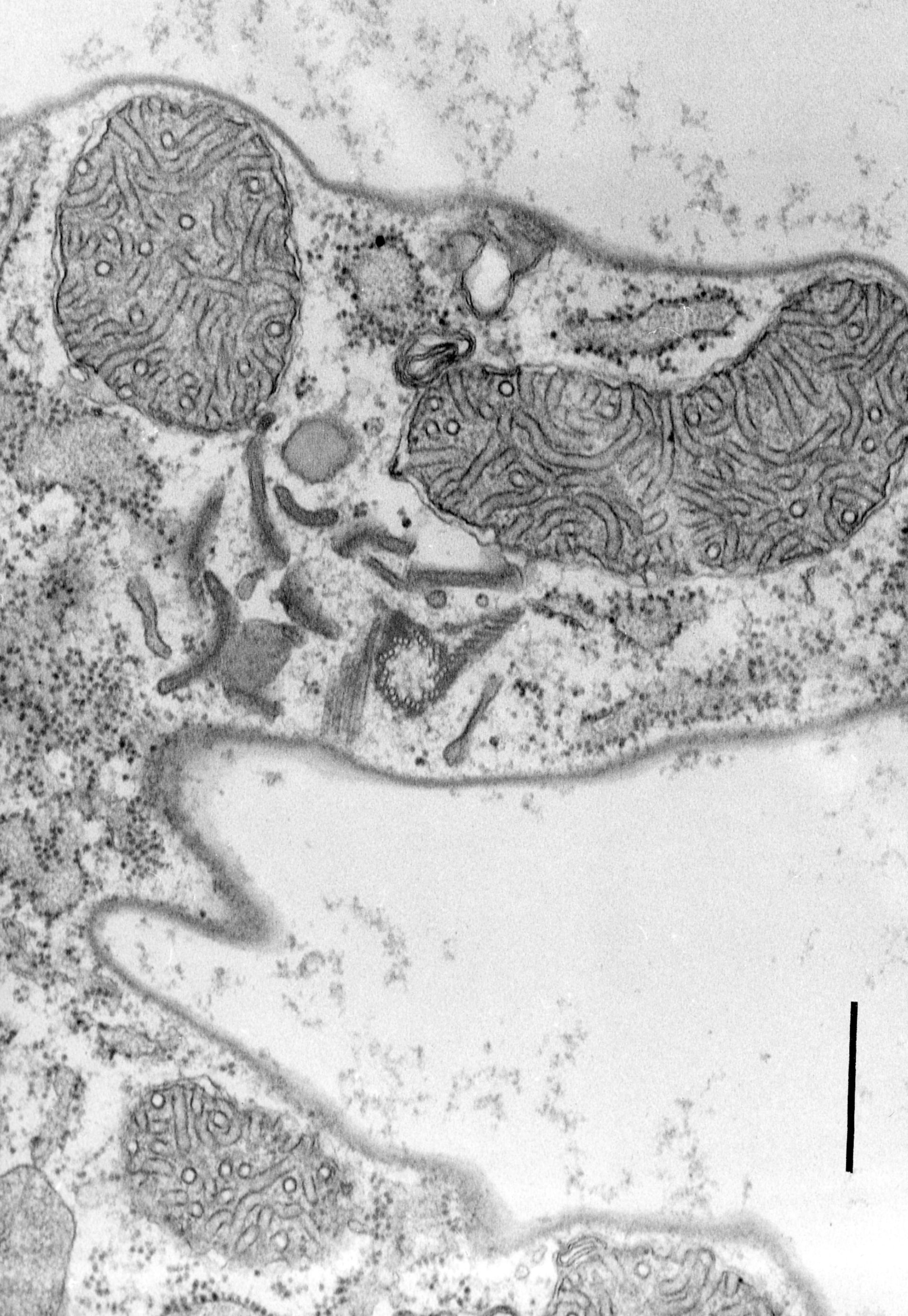 Coleps hirtus (Tubular mitochondria) - CIL:9720