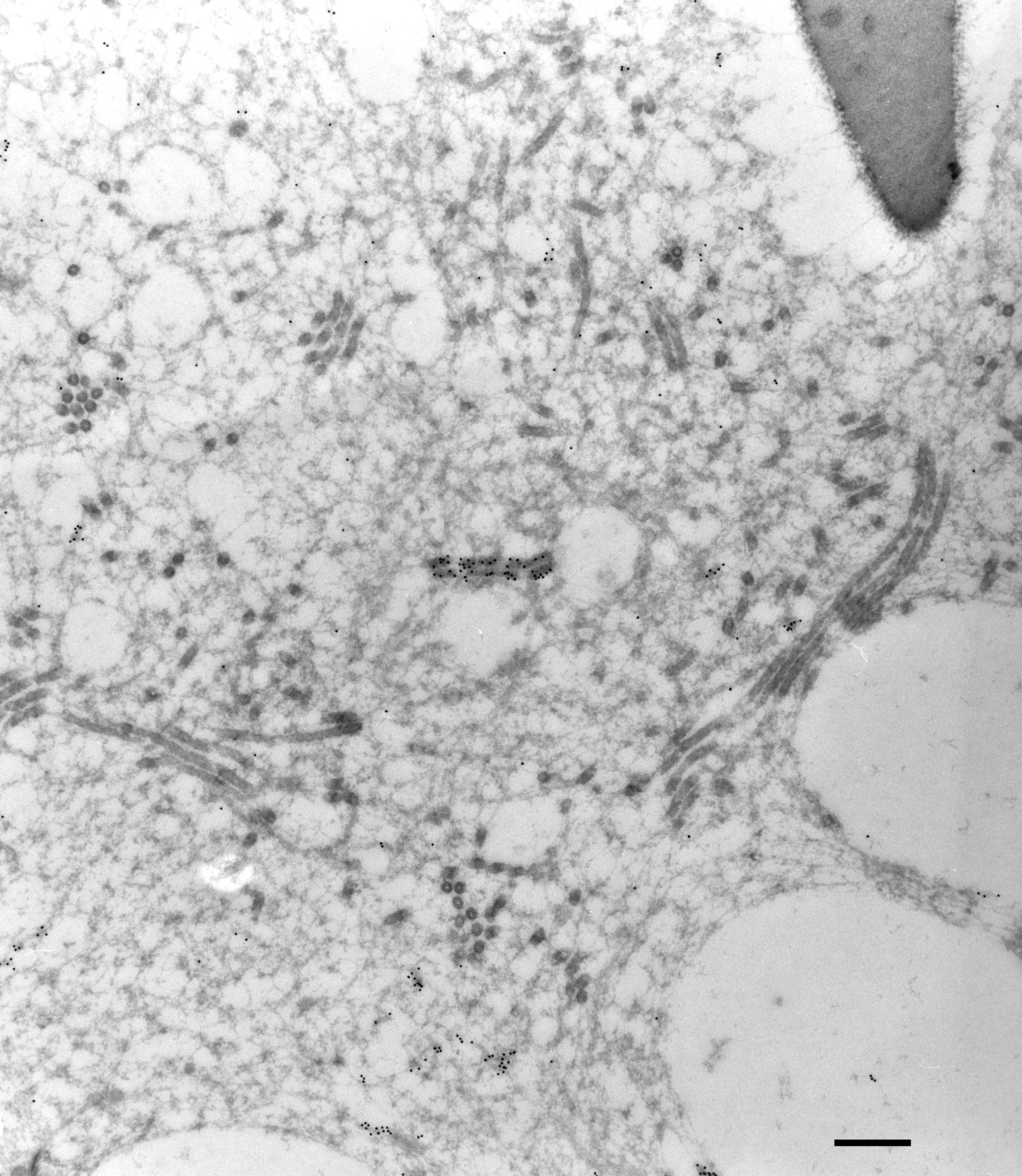 Paramecium multimicronucleatum (Cytoplasmic microtubule) - CIL:27152