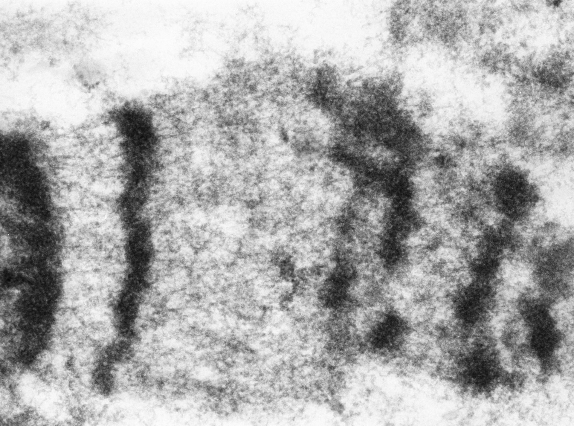 Drosophila melanogaster (Polytene chromosome) - CIL:24970