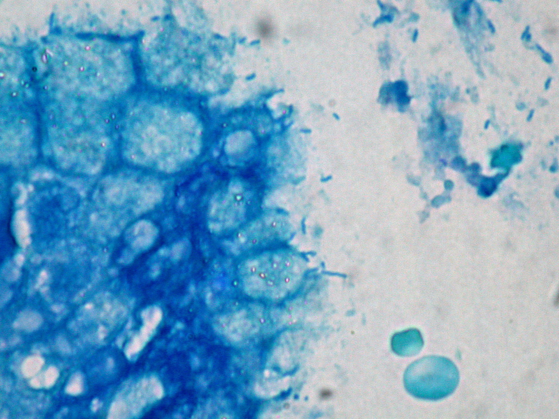 Helicobacter pylori, Magenschleimhaut (Histologie)
