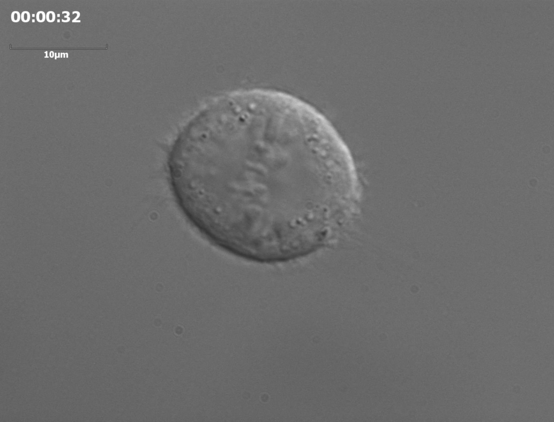 Homo sapiens (Retinal pigment epithelium) - CIL:34849