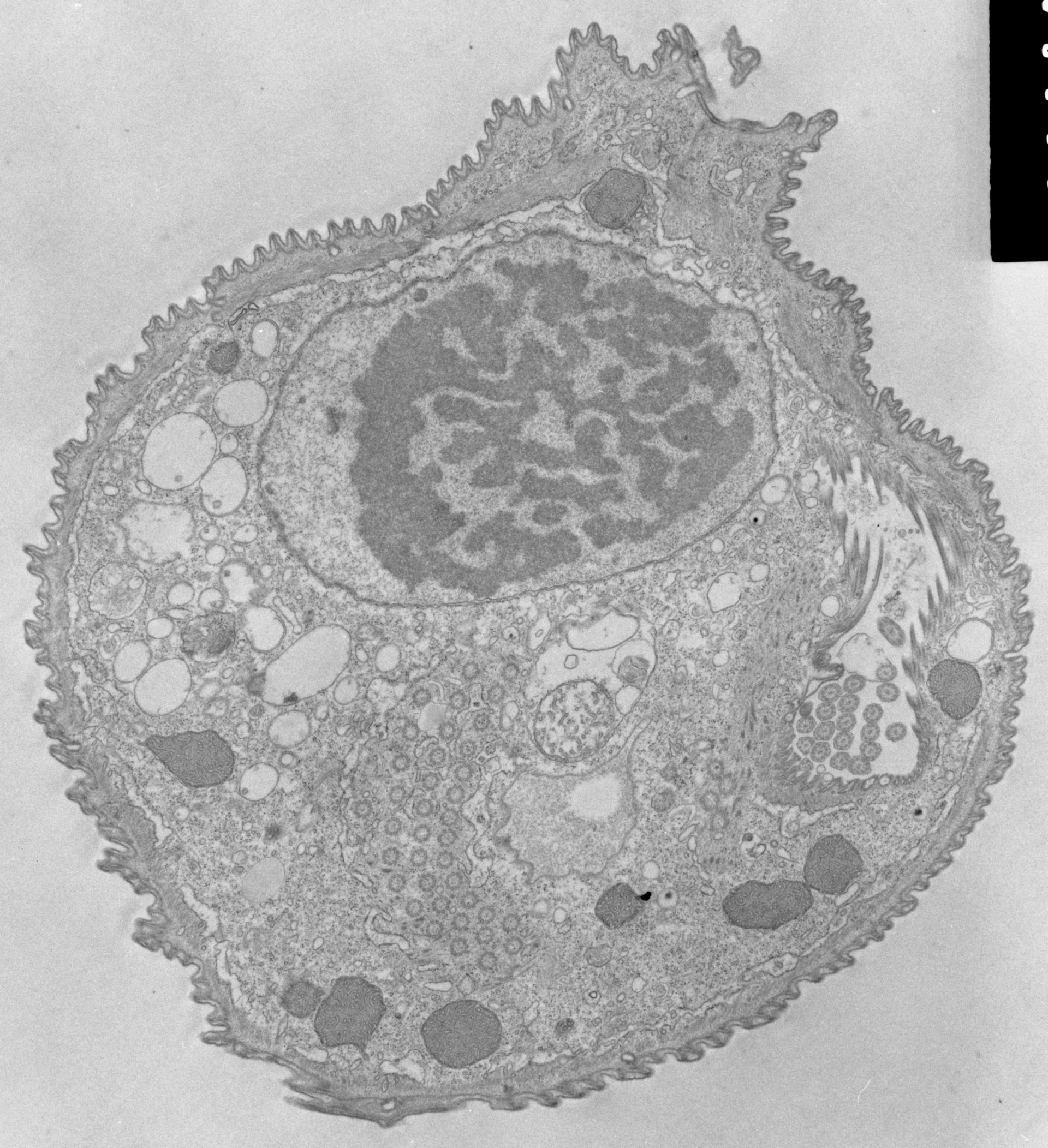 Opercularia coarctata (Cytostome) - CIL:39336