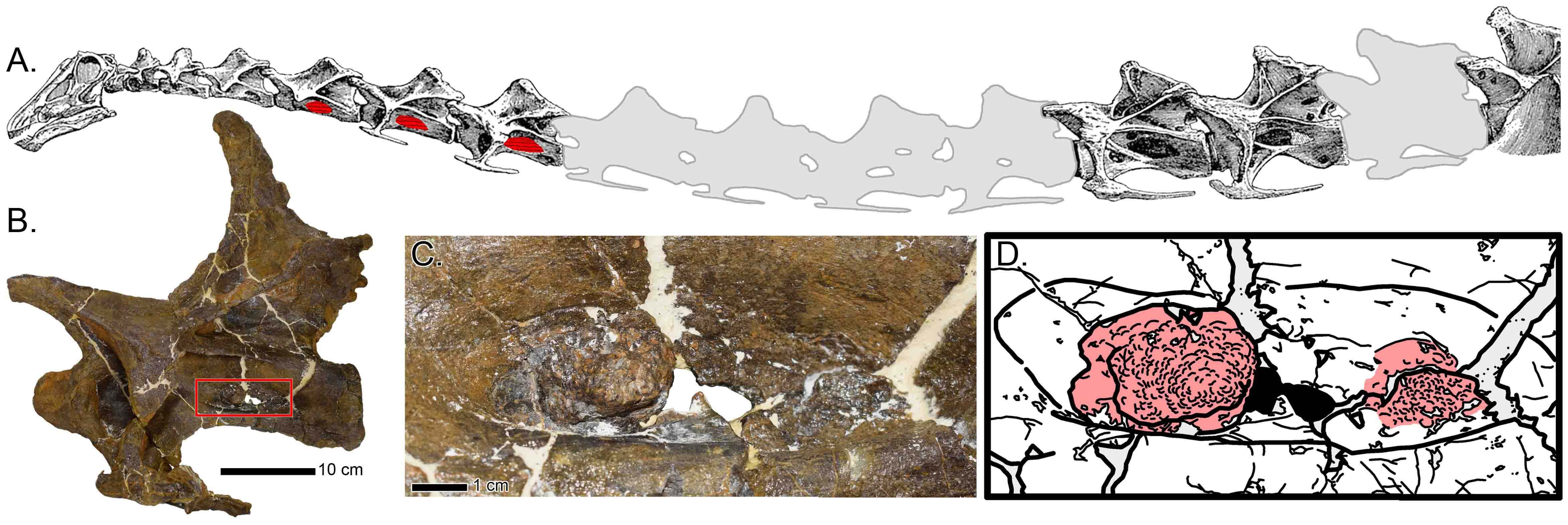 woodruff_et_al_2022_fig_1_-_infected_vertebrae_original.jpg