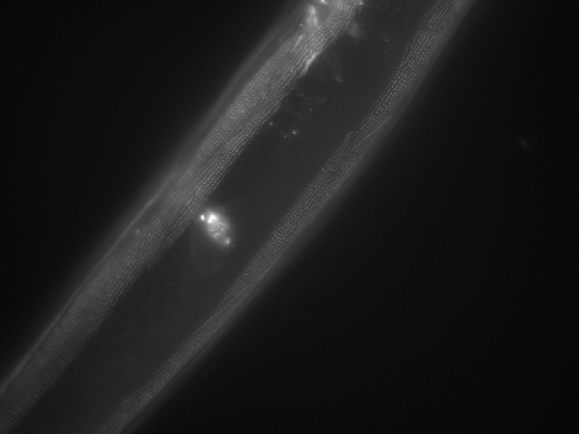 Caenorhabditis elegans (Actin filament) - CIL:1030