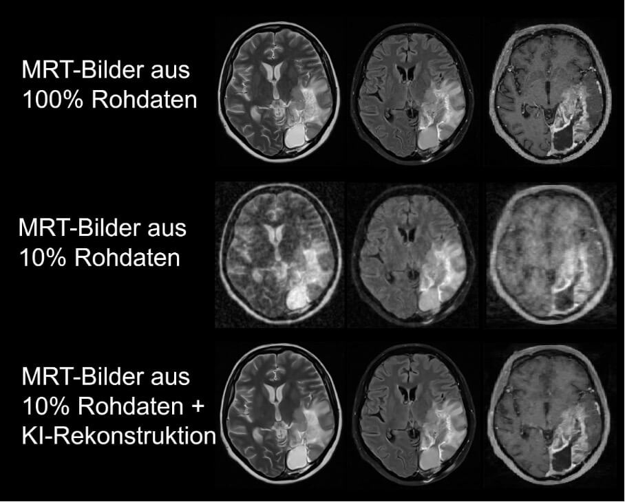 mrt-bilder_original.jpg