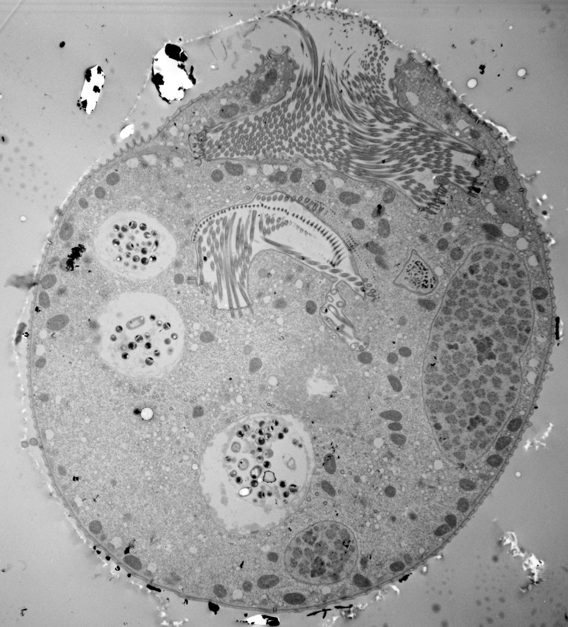 Vorticella convallaria (Contractile vacuole) - CIL:40626
