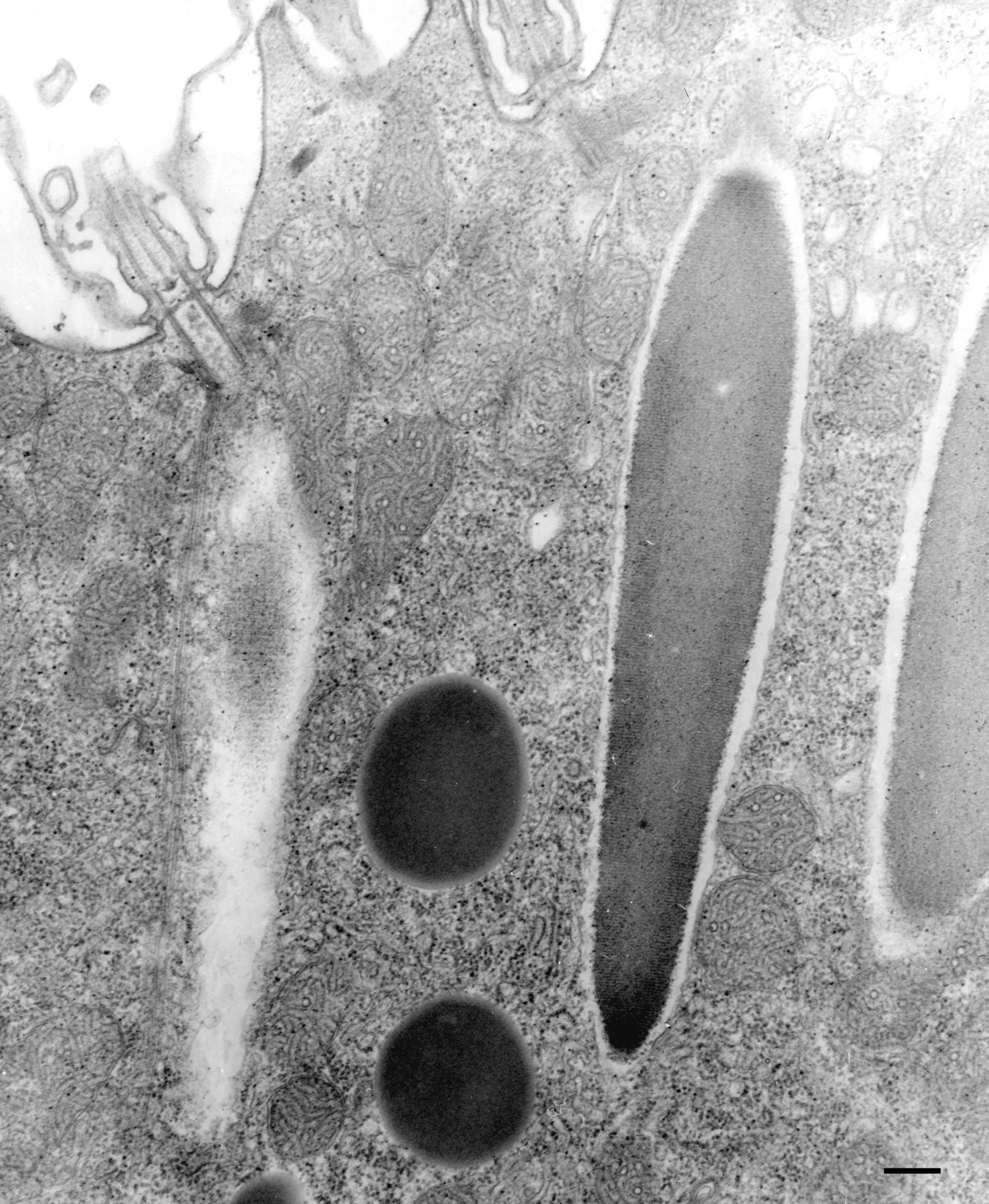 Paramecium multimicronucleatum (Cell cortex) - CIL:36681