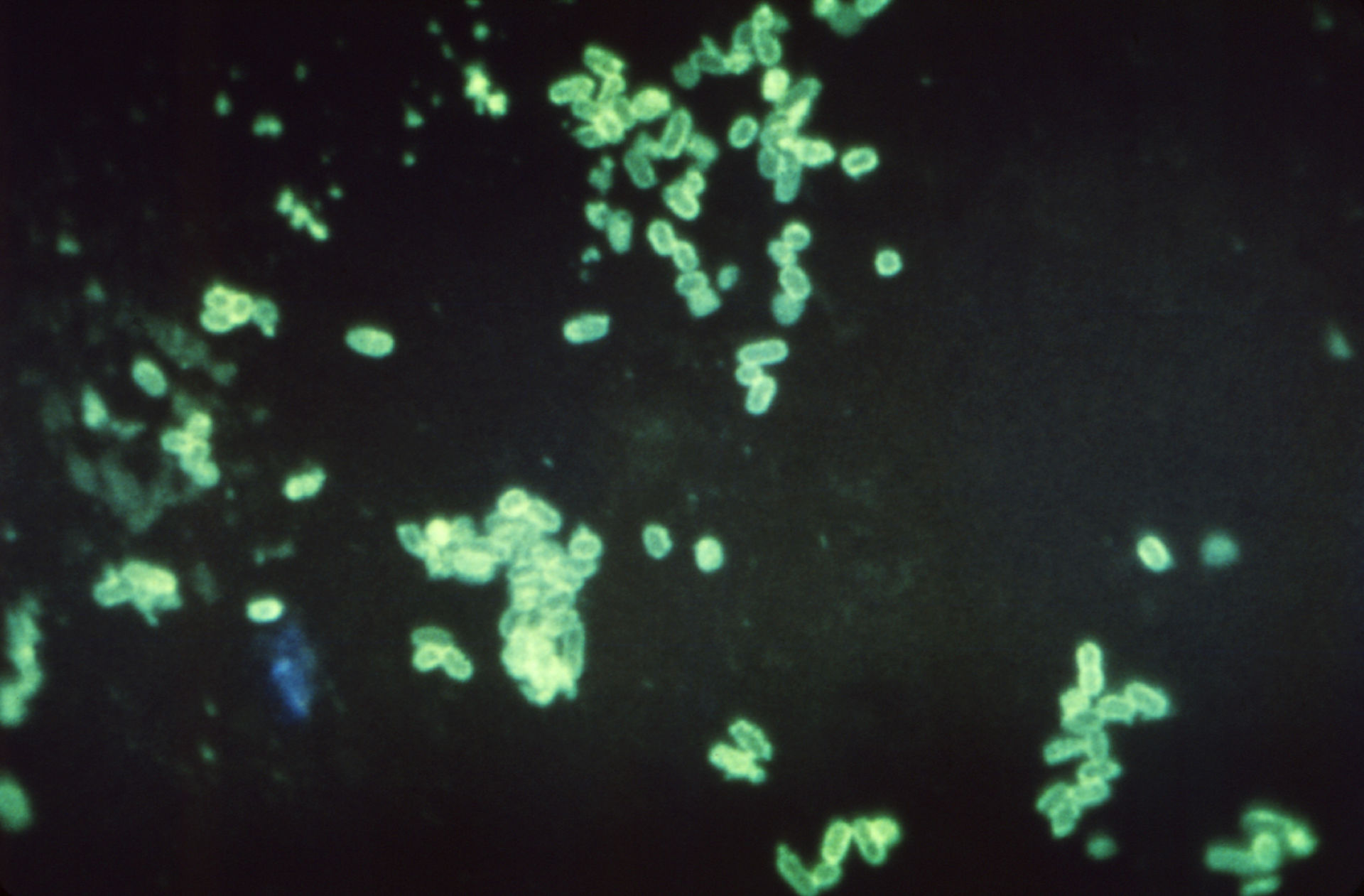 Escherichia coli Bakterien O157:H7 - DocCheck