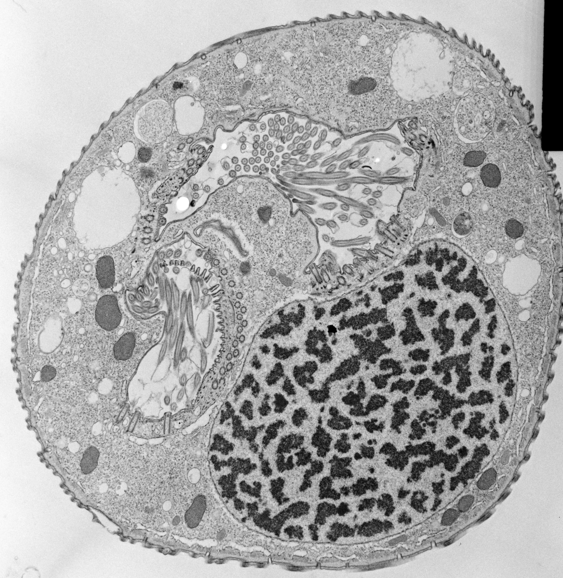 Opercularia coarctata (Cytoplasm) - CIL:39171