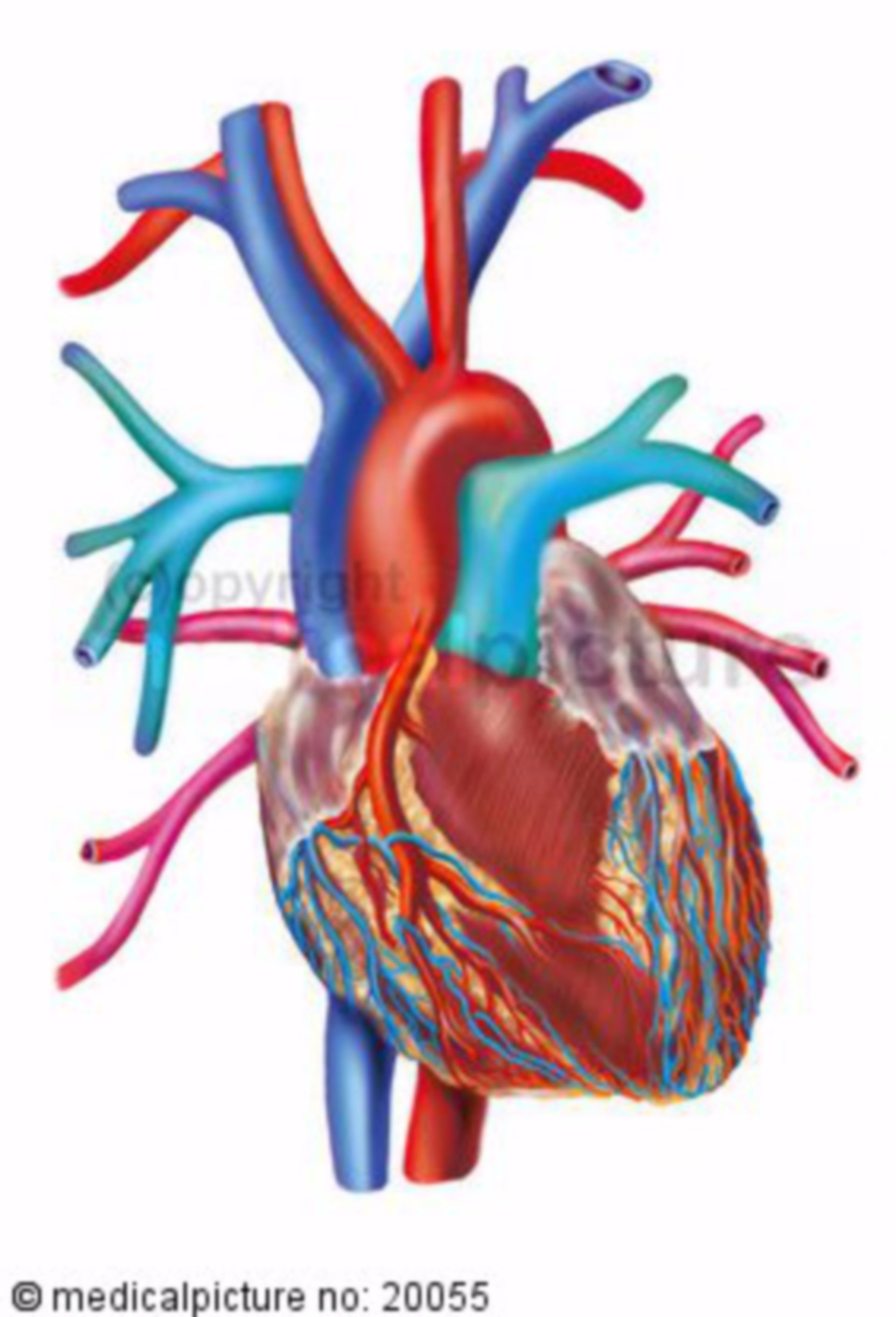 Herz mit Zufluss-, Ausflussbahnen und Herzkranzgefäßen
