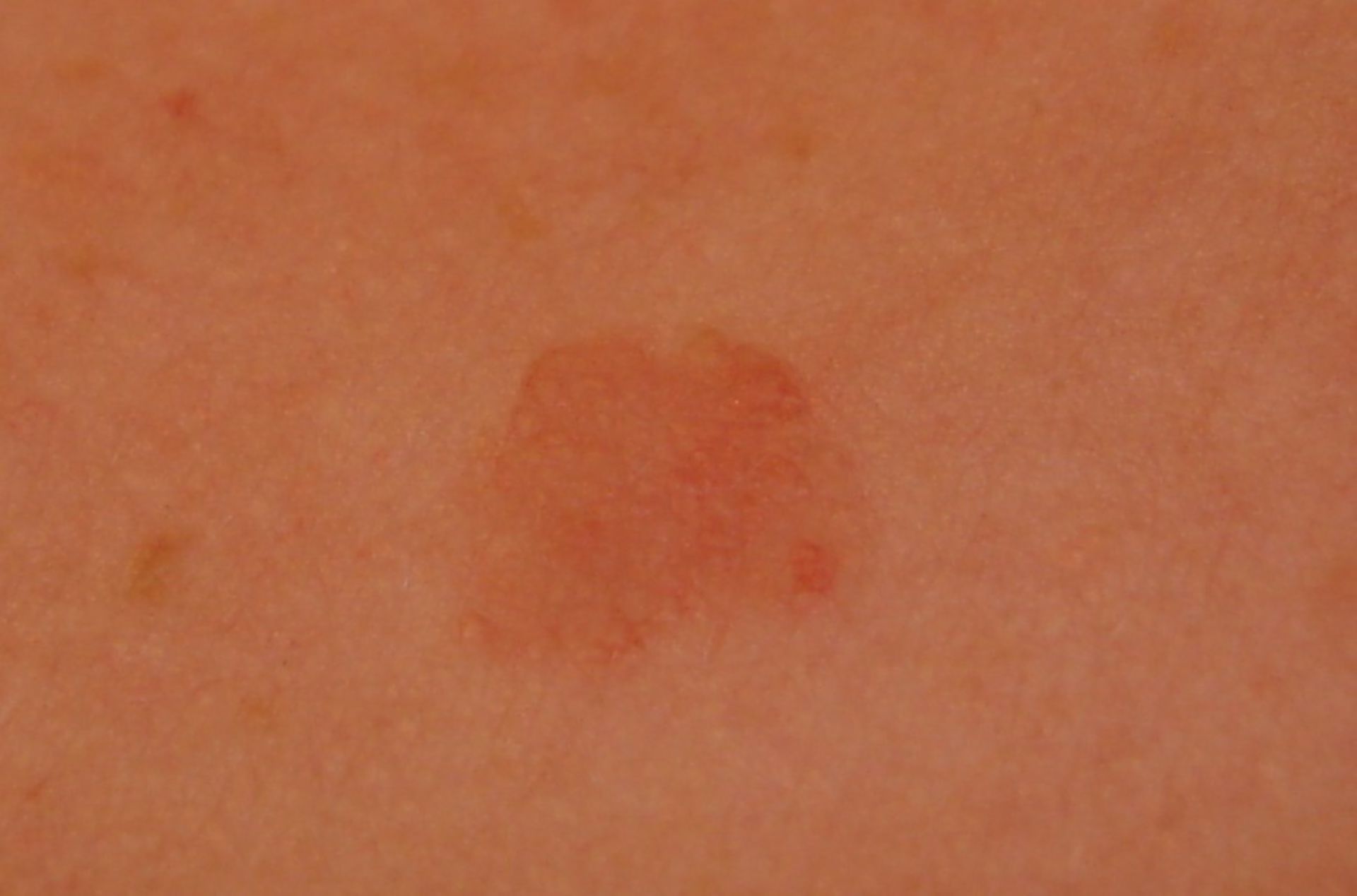Per il dermatologo?