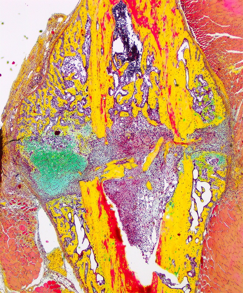 Darstellung eines gebrochenen Schienbeinknochen einer Maus nach 14 Tagen mittels Movat-Pentachromfärbung: Mineralisierter Knochen (gelb), neuer Knochen (rot), fibröses Gewebe (blaugrün), Zellkerne (violett) 