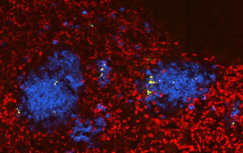 Schnitt durch eine mit Salmonellen (gelb) infizierte Milz (Rot: rote Blutkörperchen; Blau: Neutrophile). (Bild: Universität Basel, Biozentrum)