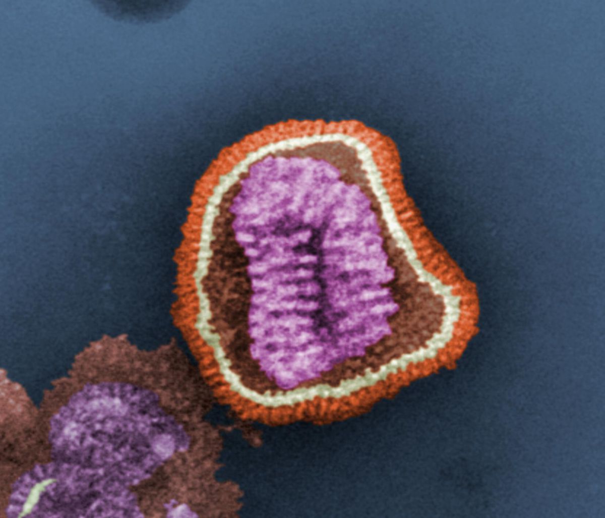 Influenzavirus (TEM, koloriert)