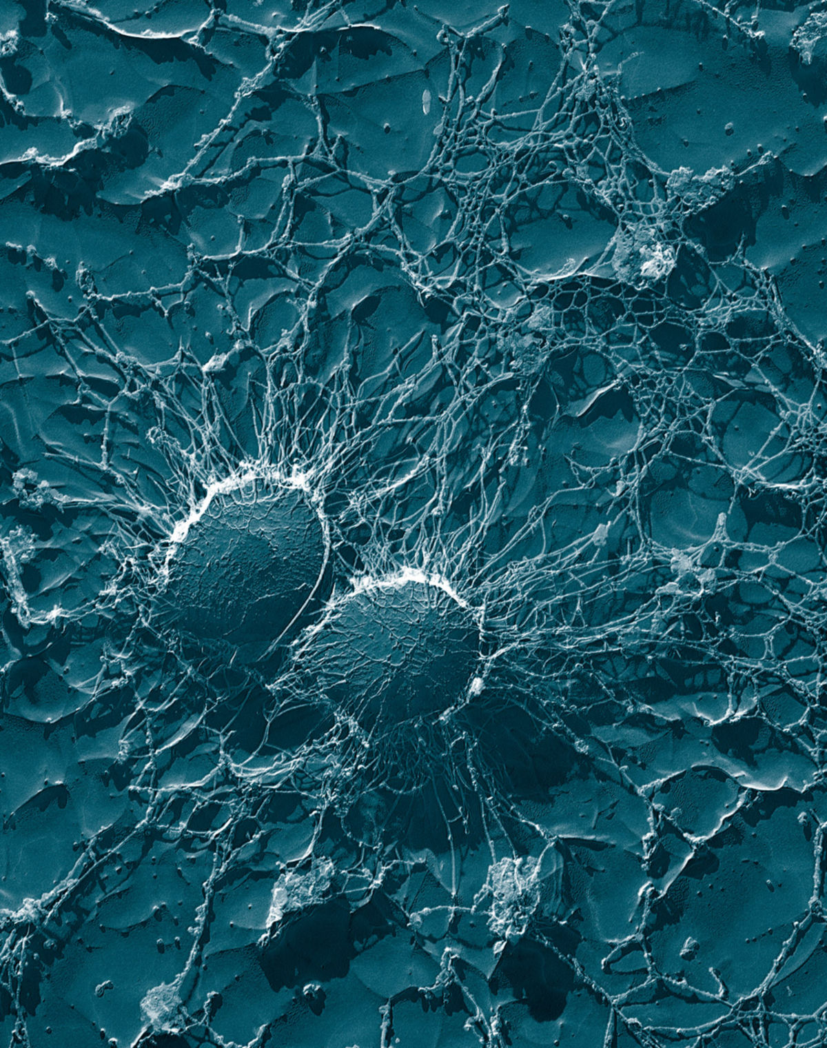 Staphylococcus aureus (50.000fache Vergrößerung)