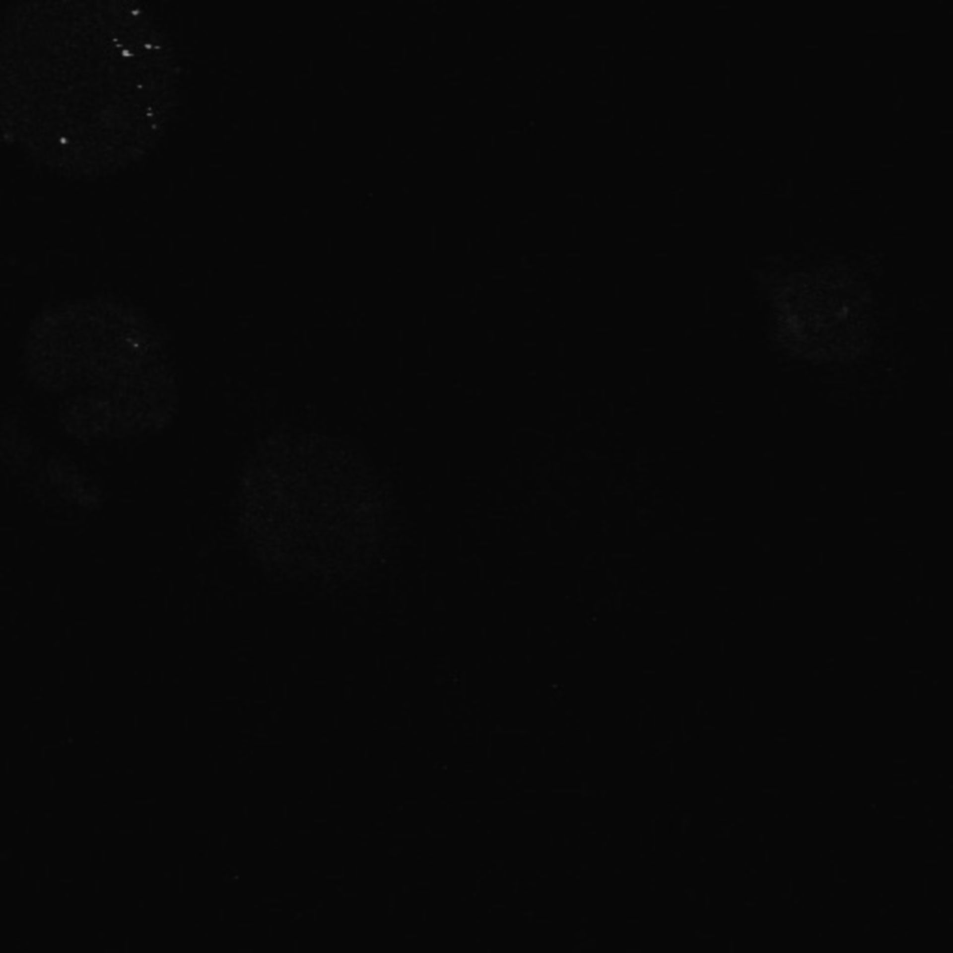 Xenopus laevis (Neuronaler Zellenkörper) - CIL:37026