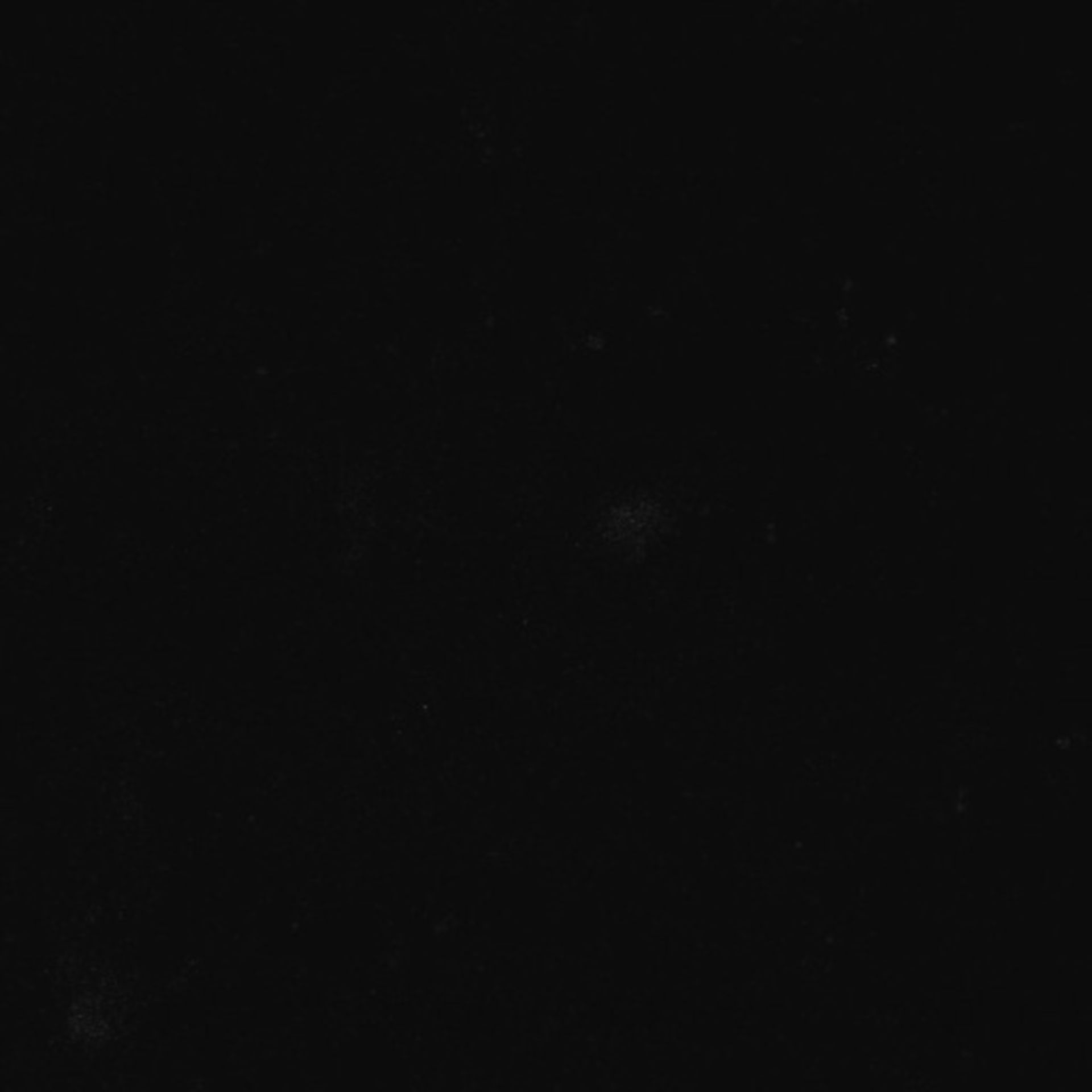 Xenopus laevis (Axon) - CIL:36915