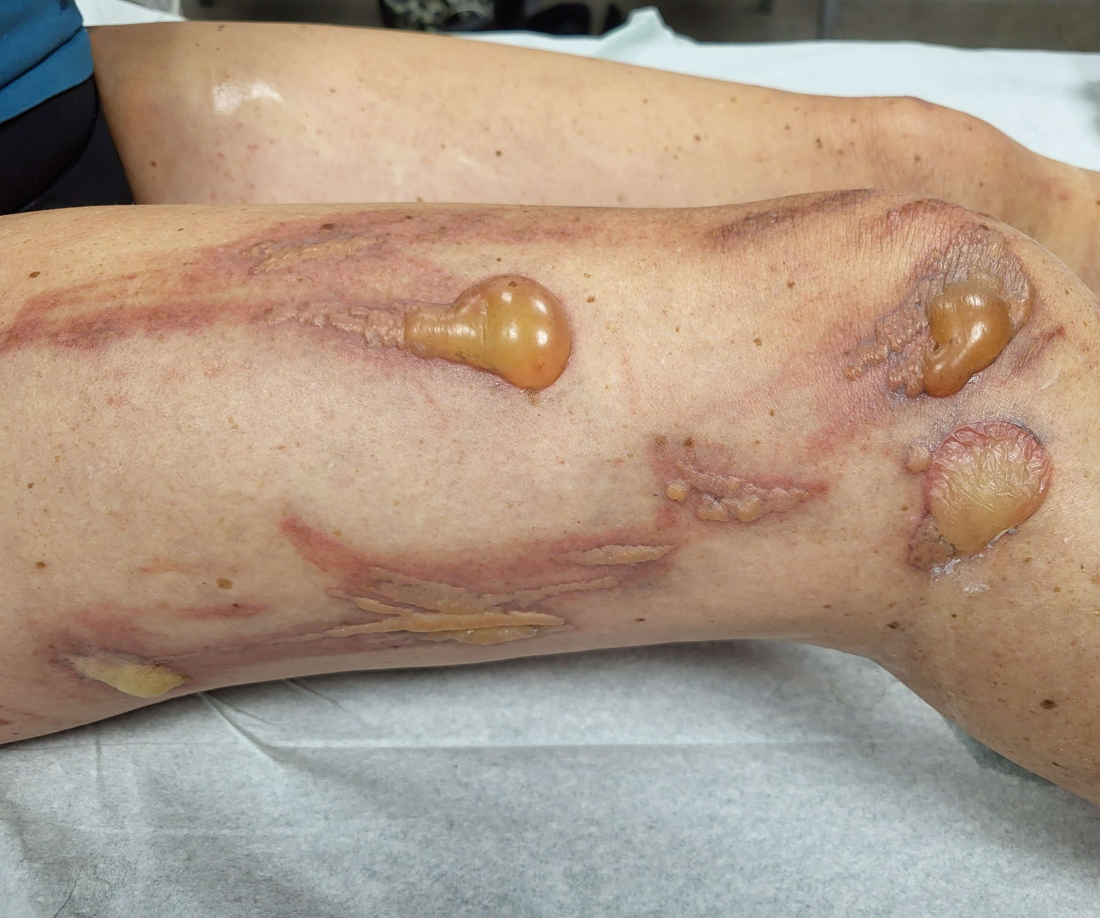 case-report_quallen-bild01.jpg_original.jpg