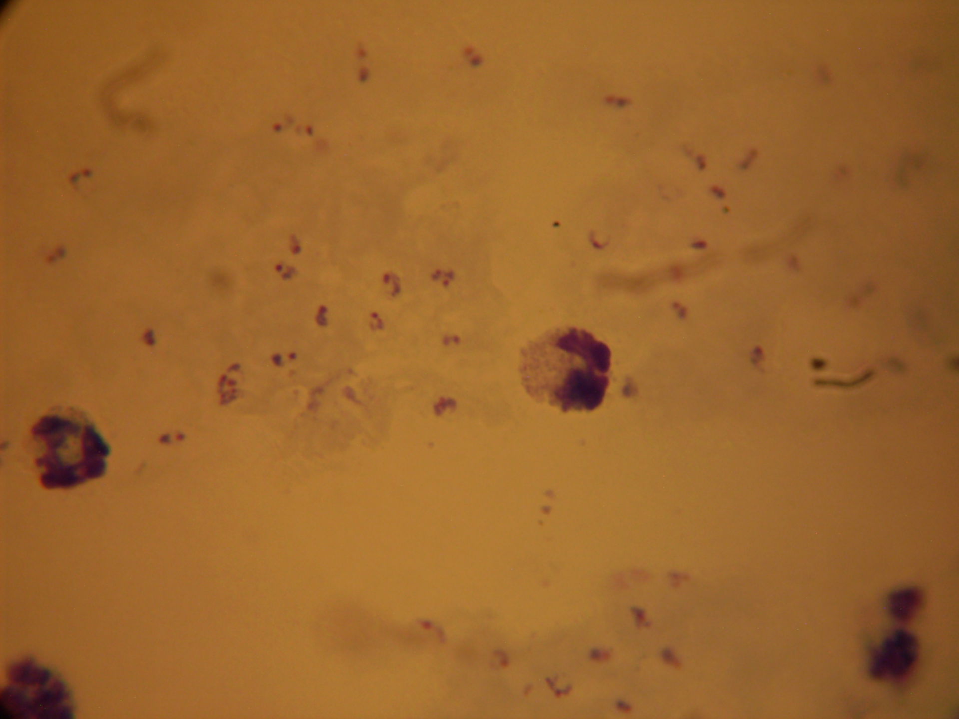 Plasmodium falciforme