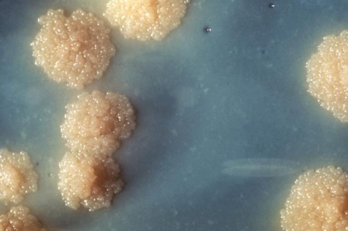 Mycobacterium tuberculosis auf Nährboden
