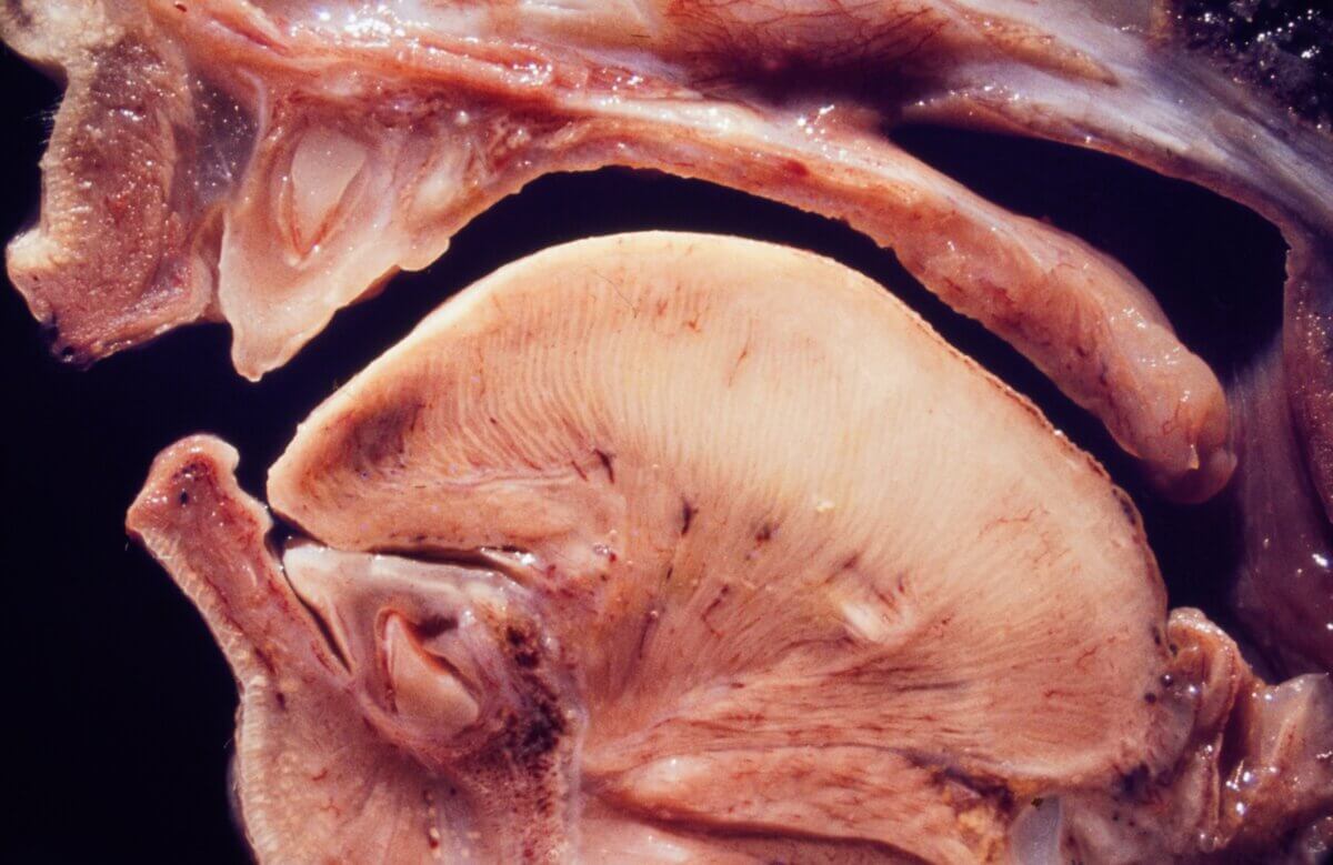 Sagittalschnitt Zunge