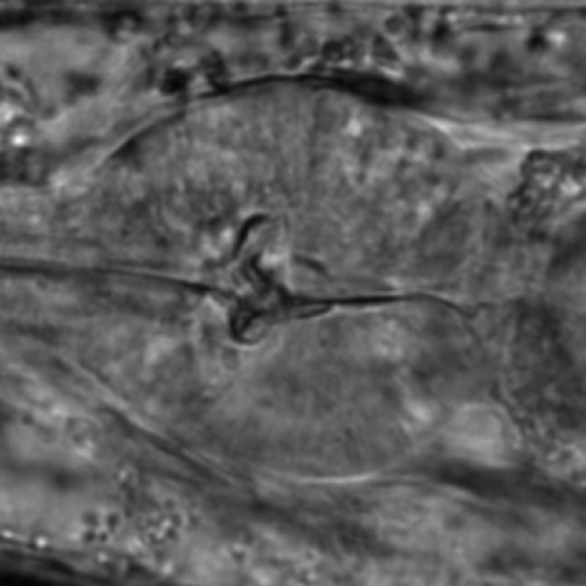Caenorhabditis elegans - CIL:1756