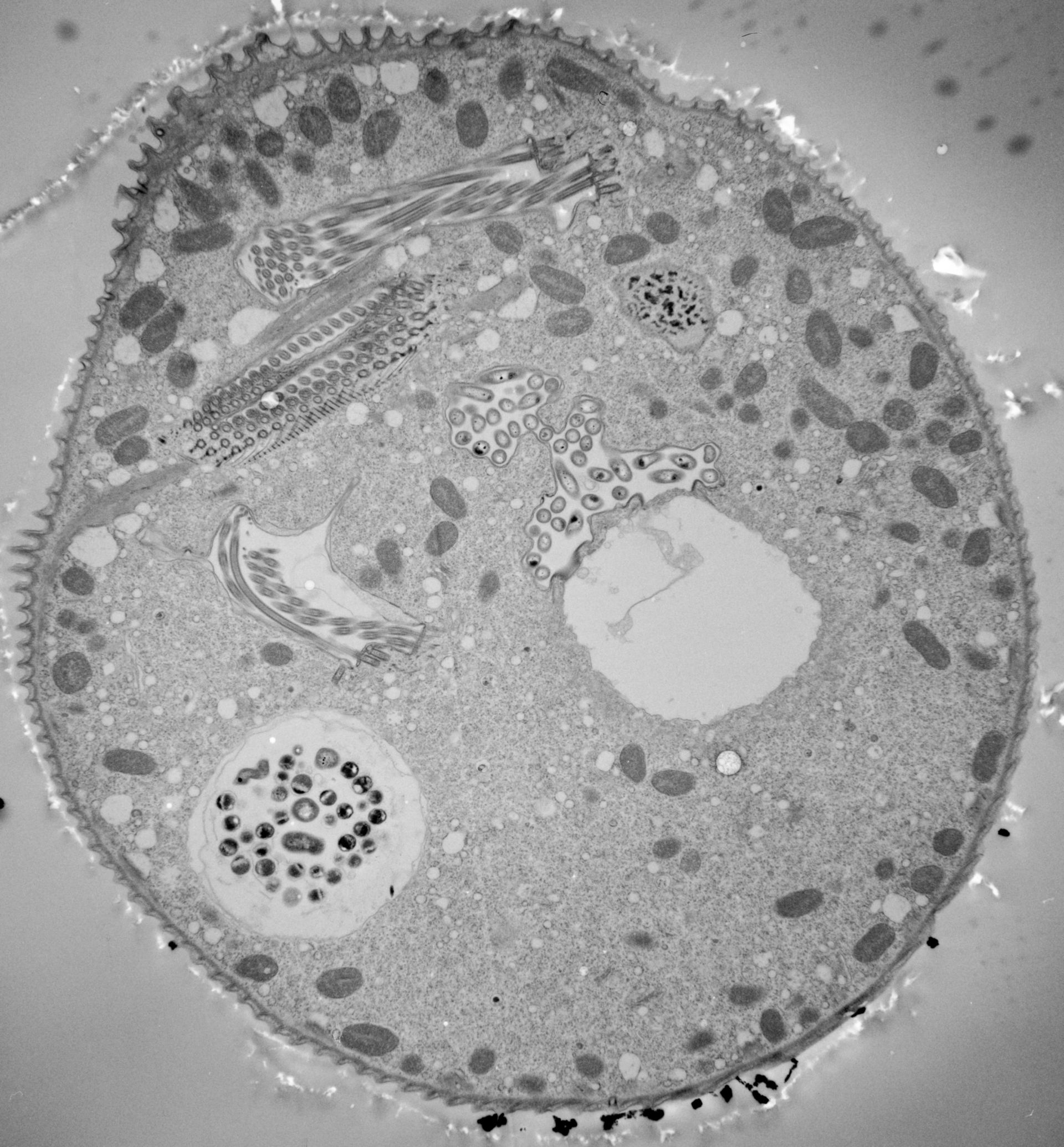 Vorticella convallaria (Food vacuole) - CIL:40570