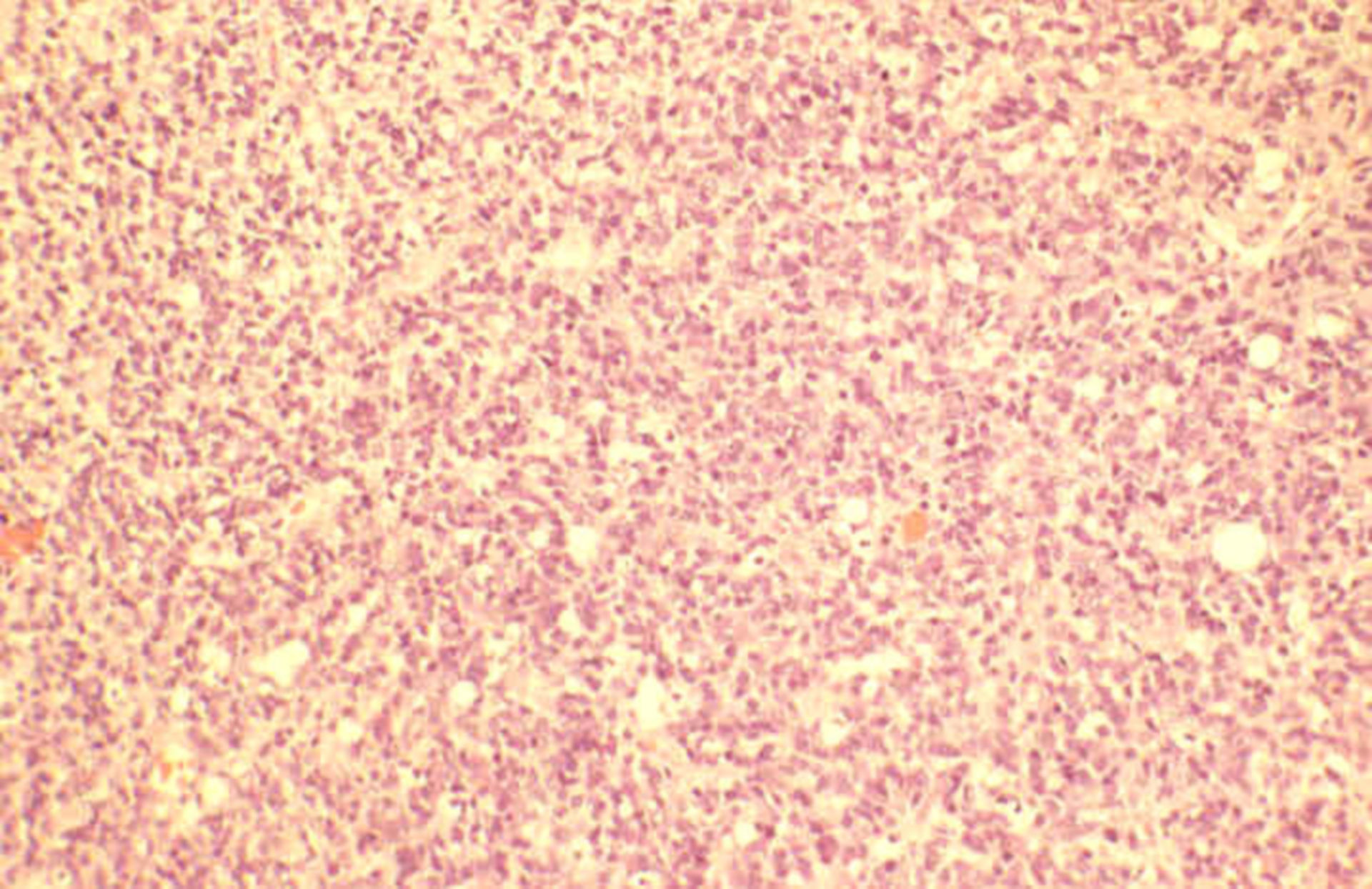 diffuse-spreading-of-nuclei-doccheck