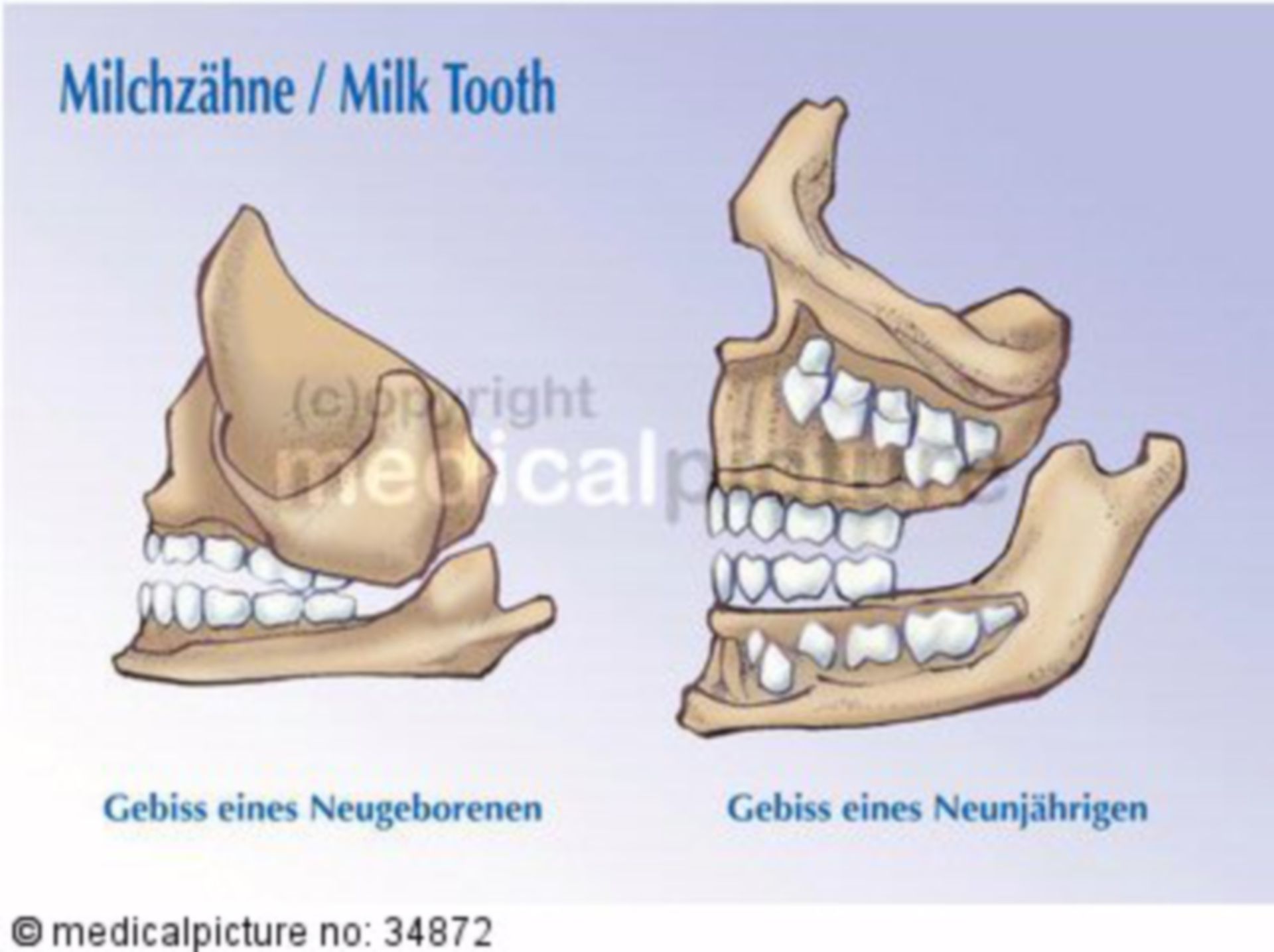  Milchgebiss 
