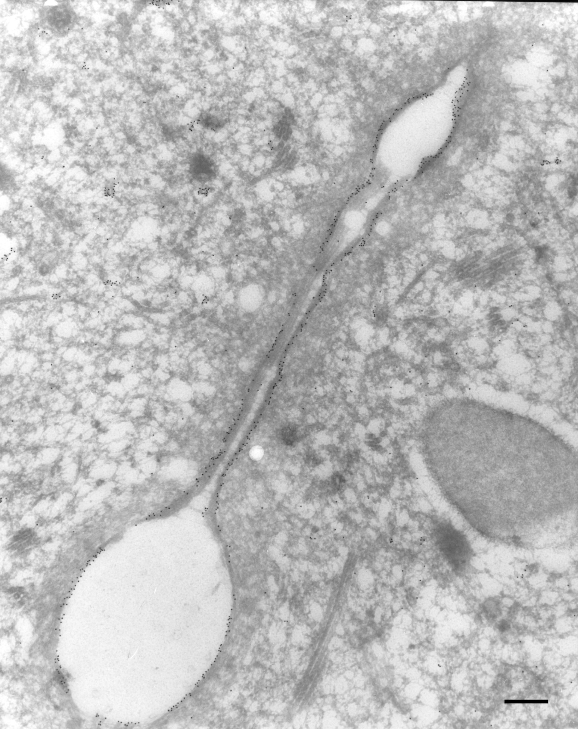 Paramecium tetraurelia (Contractile vacuole canal) - CIL:9854