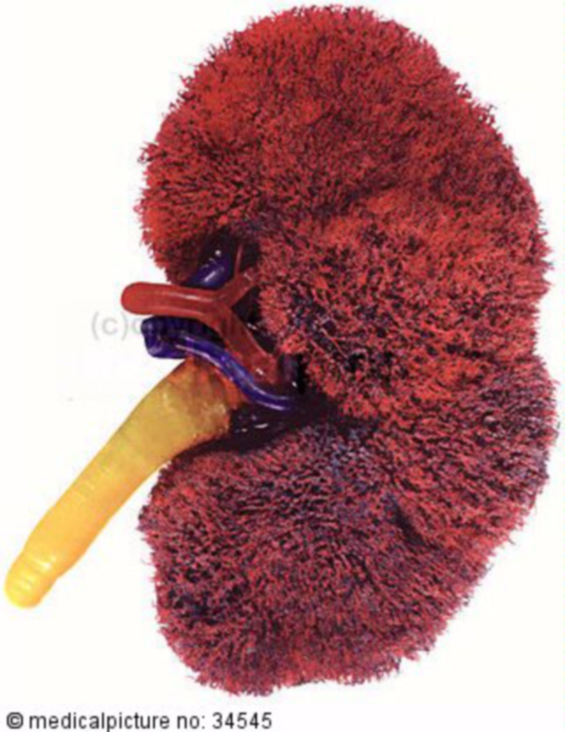  Blutgefäßnetz der Niere 
