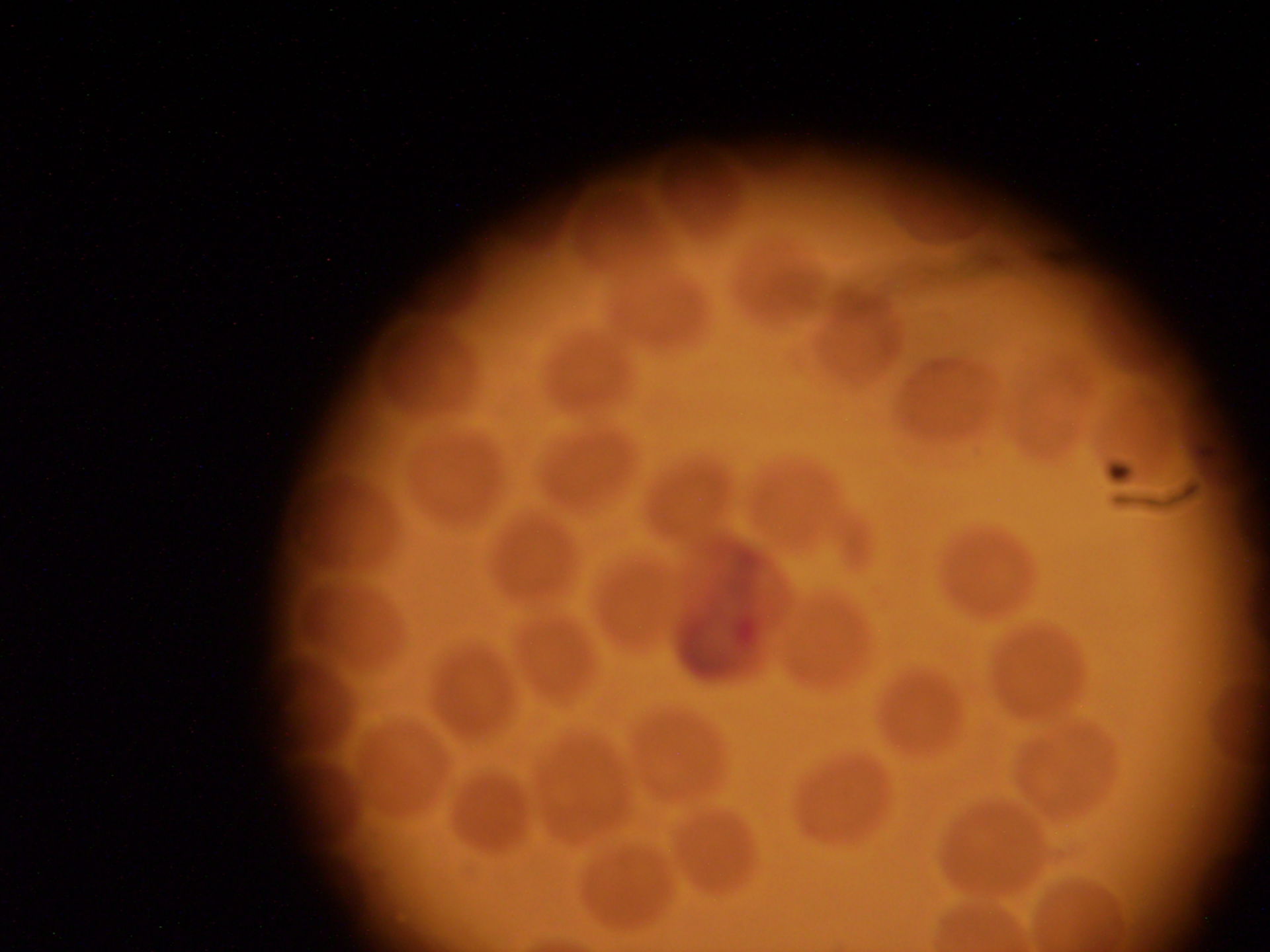 Mikroskopisches Bild des Gameten-Stadiums von Plasmodium vivax