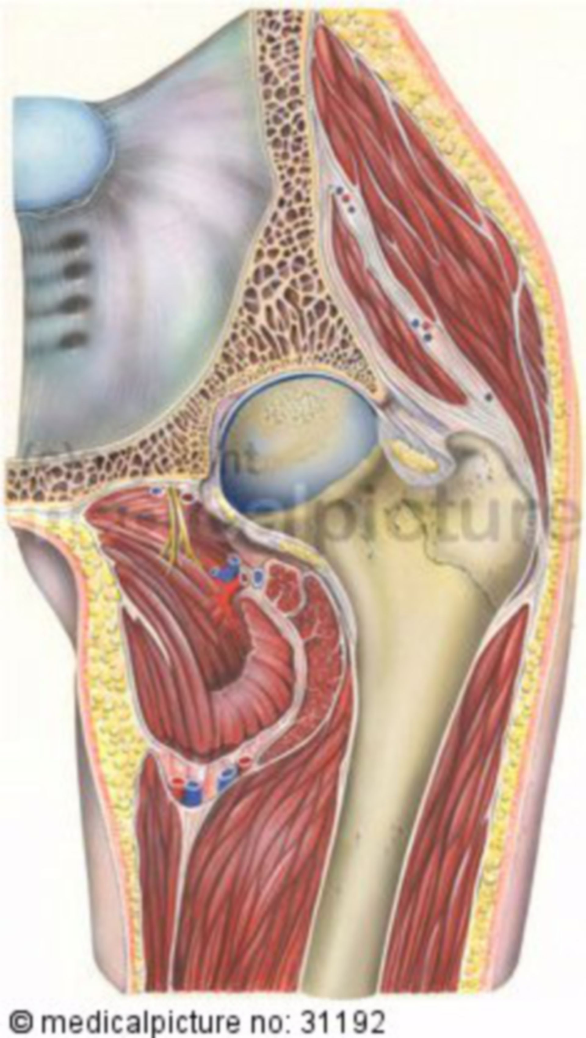 Arthrosis of the hip joint (coxarthrosis)
