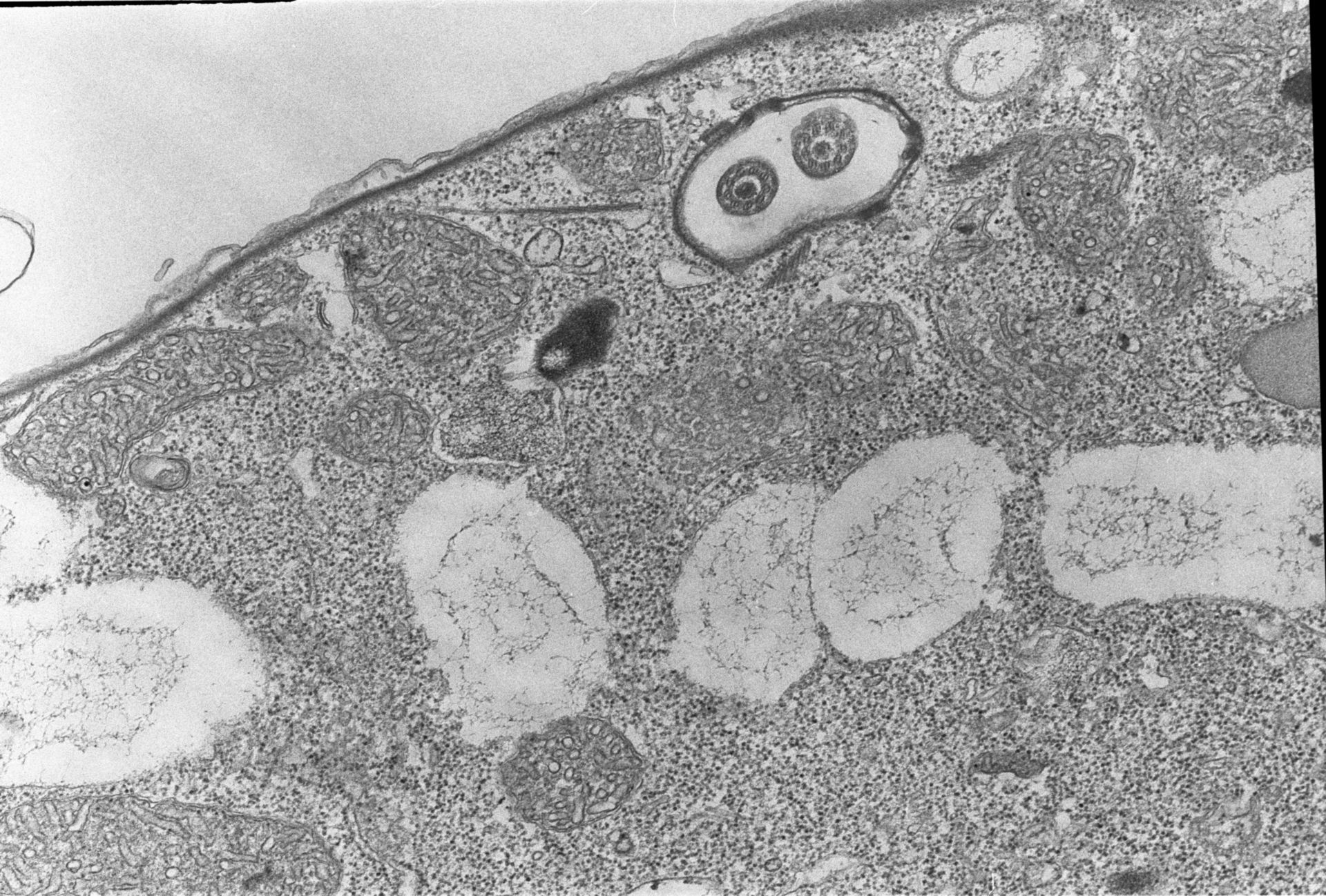 Colpoda cucullus (Cytoplasm) - CIL:2860