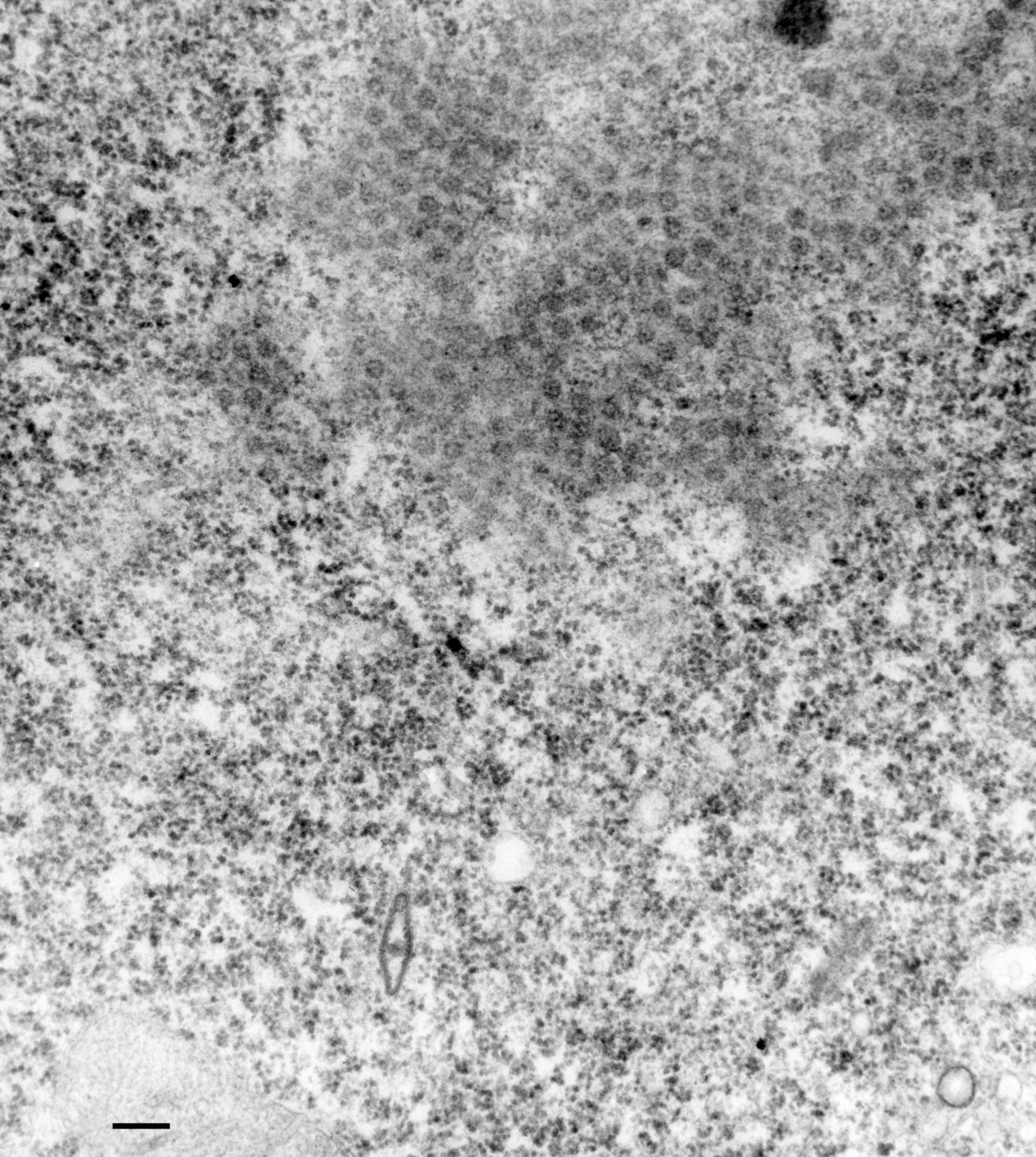 Paramecium multimicronucleatum (Nuclear pore) - CIL:36647