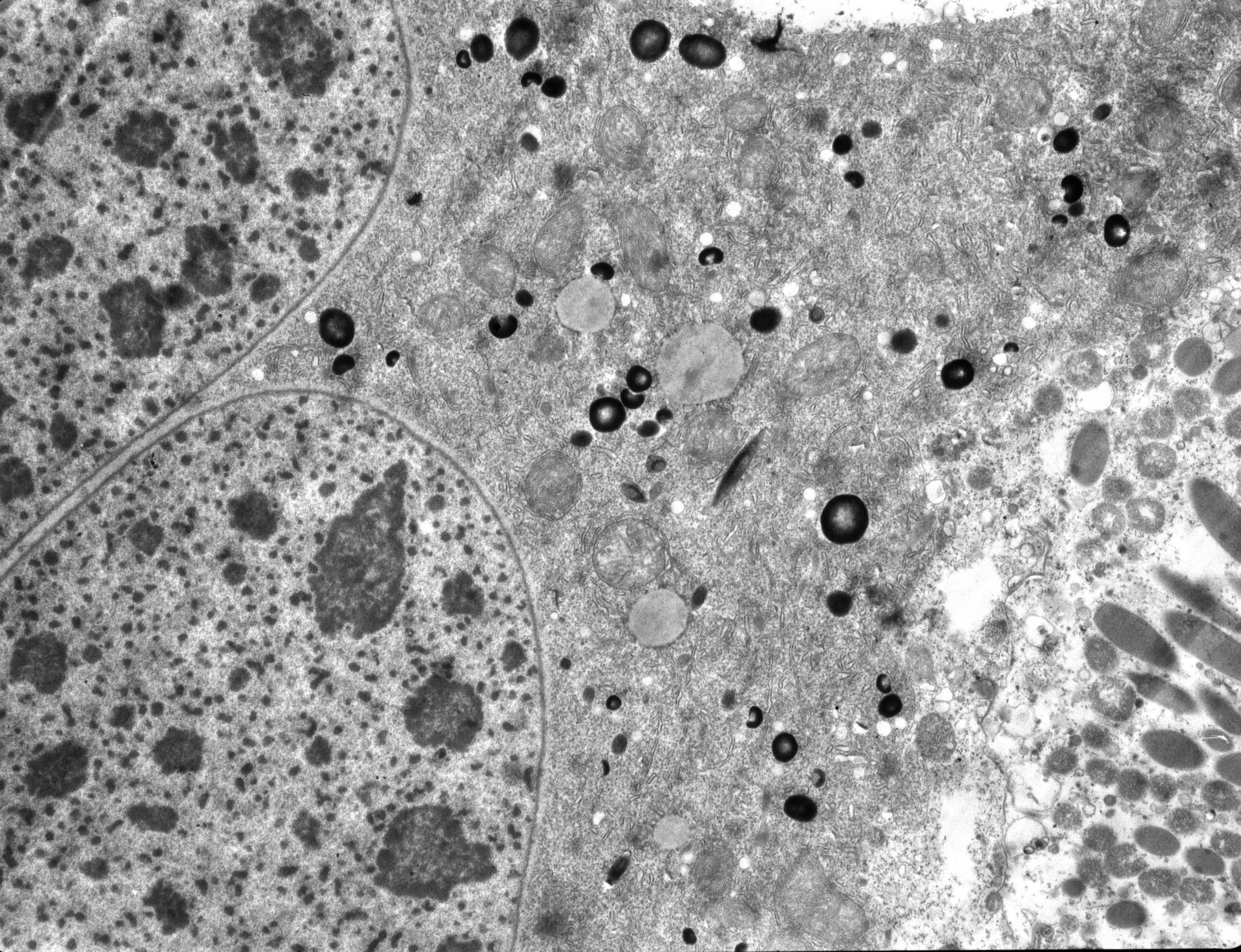 Paramecium sp. (Trichocyst) - CIL:15470 - DocCheck