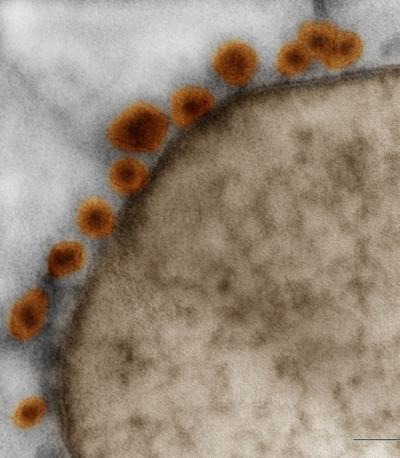 Transmissions-electronenmikroskopische Aufnahmen zeigen Zika-Viren an an einer Membran von neurogenem Gewebe, das aus iPSC stammt. © D'Or Institute for Research and Education (IDOR)