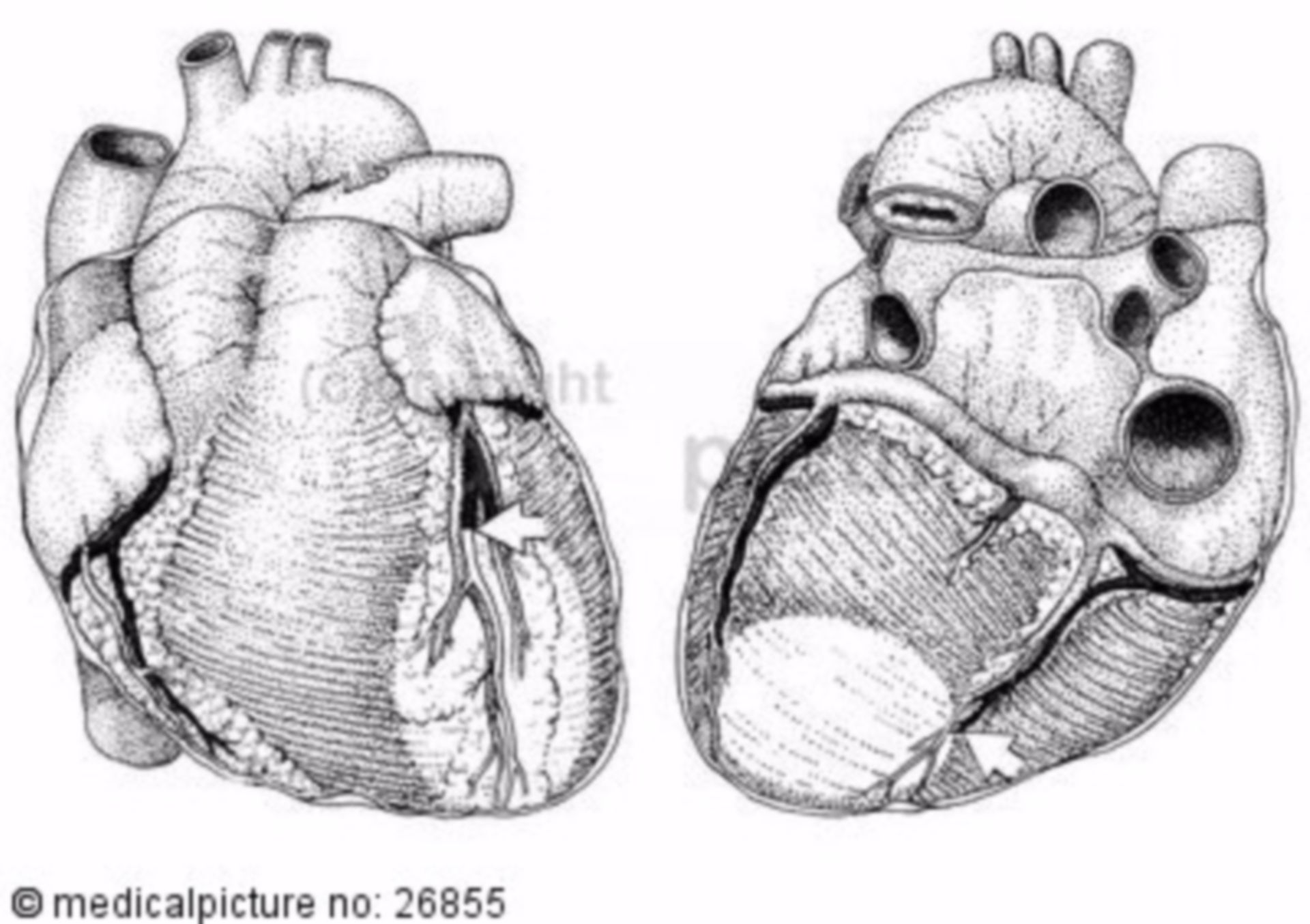 Herz, anatomischer Aufbau