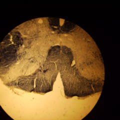 Arteria Dorsalis Scapulae Doccheck Flexikon