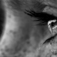 Myopie DocCheck Flexikon