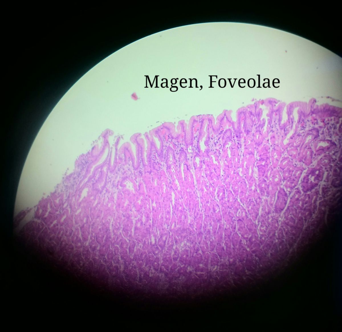 Magen-Foveolae
