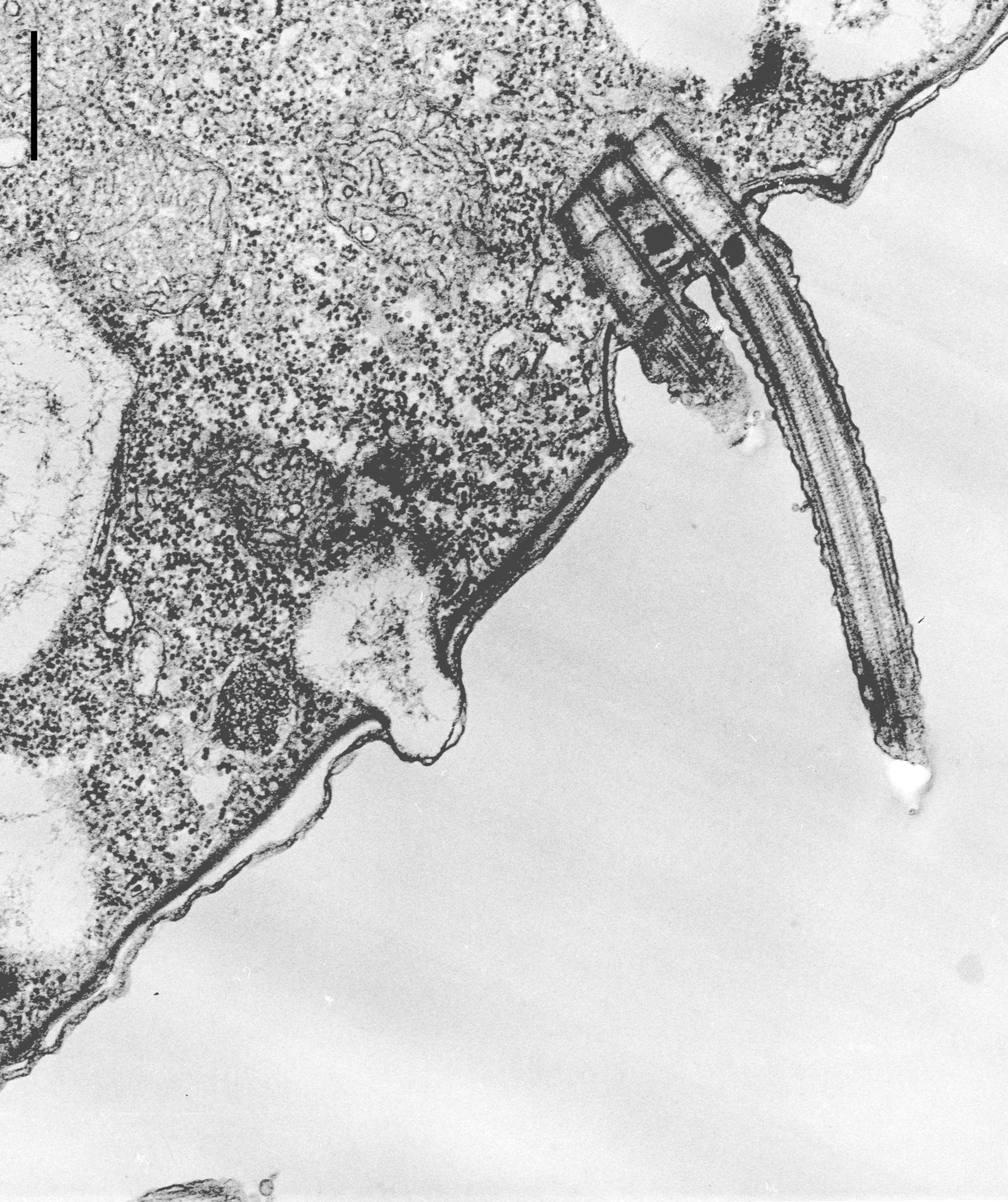 Colpoda cucullus (Cell cortex) - CIL:12104